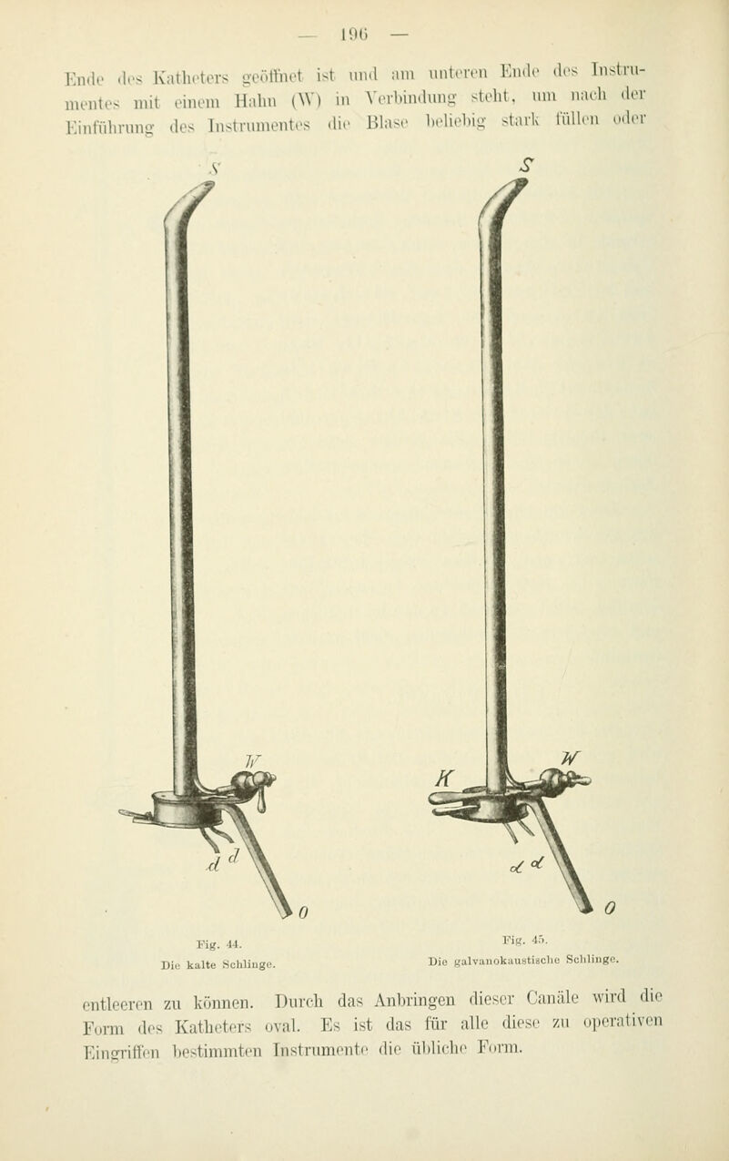 — 19ü — Ende des Katheters geöttnrt iM mi.l nm unteivii Ende dis Tnstnt- nu-iites mit einem H:dm (W) m W^lnmlimg steht, um muh dcv Kinfühnmo- des Tustnimentes dir Blase heUehi- sl;uk lüllrn o.I.m- Fig. 44. Dil; kalte Schlinge. / Fig. 4.'), Die galvanokaustiaclio Sclilingc. entleeren zu können. Durch das Anhringen dieser Canäle wird die Form des Katheters oval. Es ist das für alle diese zu operativen Eingriffen bestimmten Instrument^ diu ül)liche Form.