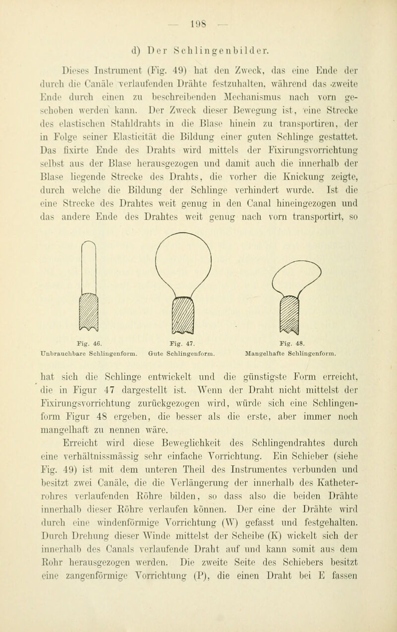 d) Der Seh 1 i 11 ge n b i 1 d c r. Dieses Instniiucnt (Fig. 49) hat den Zweck, das vlnv VauIv dw dureh die Caiiäle verhiufenden Drähte festzuhalten, während (his -/weite linde durch einen 7,u beschreihenden ]\[eelianismus naeh vuni ge- schoben werden kann. Der Zweck dieser Bewegung ist, eine Strecke des elastischen Stahldrahts in die Blase hinein zu transportiren, der in Folge seiner Elasticität die Bildung einer guten Schlinge gestattet. Das fixii'te Ende des Drahts wird mittels der FLxirungsvorrichtung selbst aus der Blase herausgezogen und daniit auch die innerhalb der Blase liegende Strecke des Drahts, die vorher die Knickung zeigte, durch welche die Bildung der Schlinge verhindert wurde. Ist die eine Strecke des Drahtes weit genug in den Canal hineingezogen und das andere Ende des Drahtes weit genug nach vorn transportirt, so /'-^ m Fig. 46. Fig. 47. Unbrauchbare Schliugeufoim. Gute Schlingenform. Fig. 48. Mangelhafte Schliugcnform. hat sich die Schlinge entwickelt und die günstigste Form en-eicht. die in Figur 47 dargestellt ist. Wenn der Draht nicht mittelst der Fixirungsvorrichtung zurückgezogen wird, würde sich eine Schlingen- form Figur 48 ergeben, die besser als die erste, aber immer noch mangelhaft zu nennen wäre. EiTeicht wird diese Beweglichkeit des Schiingendrahtes durch eine verhältnissmässig sehr einfache Vorrichtung. Ein Schieber (siehe Fig. 49) ist mit dem unteren Theil des Instrumentes verbvniden und besitzt zwei Canäle, die die Verlängerung der innerhalb des Kathetei- rohres verlaufenden Röhre bilden, so dass also die beiden Drähte innerhalb dieser Röhre verlaufen können. Der eine der Drähte wiid durch eine windenförmige Vorrichtung (W) gefasst und festgehalten. Durch Drehung dieser Winde mittelst der Scheibe (Iv) wickelt sich der innerhalb des Canals verlaufende Draht auf und kann somit aus dem Rohr herausgezogen werden. Die zweite Seite des Schiebers besitzt eine zangenförmige Vorrichtung (P), die einen Draht bei E fassen