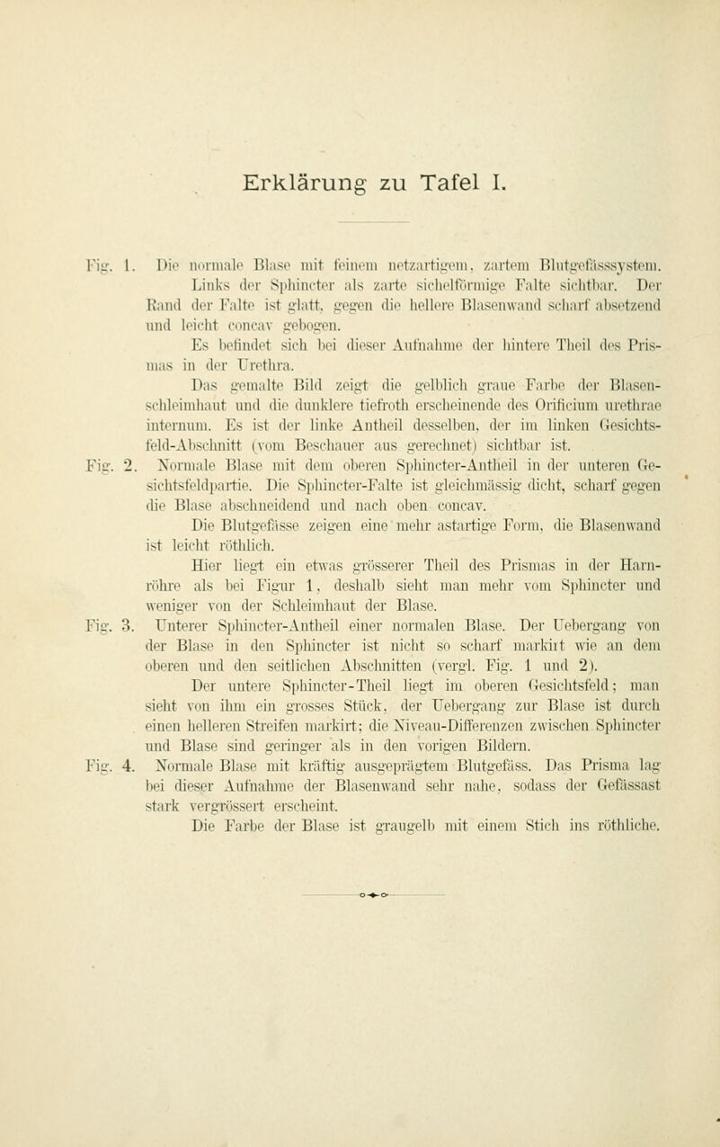 Erklärung zu Tafel 1. Fisr. 1. Dio noriiKili* Blase mit toiiiein iiotzartiiicin. zartem Hliitgetasssysteni. Links der Si>liinctor als zarte sichcltornni'e Falte sichtbar. Der Rand der Falte ist glatt, gegen dio !iel!iM-e Blasenwand seliarf absetzend und leicht concav gebogen. Es befindet sich bei dieser Aulhalimt' der hintciv Tlii'ü des Pris- mas in der Urethra. Das gemalte Bild zeigt die gelblich graue Farbe der Bhisen- schleimhaut und die dunklere tiefroth erscheinende des Orificium urethrae iiiternum. Es ist der linke Autheil desselben, der im linken Gesichts- feld-Absehnitt (vom Beschauer aus gerechnet) sichtbar ist. Fig. 2. Xormale l^lase mit dem oberen Sphincter-Antheil in der unteren Ge- sichtsfeldpartie. Die Spliincter-Falte ist gleichmässig dicht, scharf gegen die Blase abschneidend und nach oben concav. Die Blutgefässe zeigen eine mehr astartige Form, die Blasenwand ist leicht röthlich. Hier liegi. ein etwas grösserer Theil des Prismas in der Harn- röhre als bei Figur 1. deshalb sieht man mehr Vdiu Sphiiictei' und weniger von der Schleimhaut der Blase. Fig. 3. Unterer Spliincter-Antheil einer normalen Blase. Der Uebergang von der Blase in den Spliincter ist nicht so scharf markiit wie an dem oberen und den seitlichen Abscluiitten (vergl. Fig. 1 und 2). Der untere Sphinctcr-Theil liegt im oberen Gesichtsfeld; man sieht von ihm ein grosses Stück, der Uebergang zur Blase ist durch einen helleren Streifen markirt; die Niveau-Differenzen zwischen Si)hincter und Blase sind geringer als in den vorigen Bildern. Fig. 4. Normale Blase mit kräftig ausgeprägtem Blutgefäss. Das Prisma lag bei dieser Aufnahme der Blasen wand sehr nahe, sodass der Gefässast stark vergrössert erscheint. Die Farbe der Blase ist graugelli mit einem Stich ins röthliche.