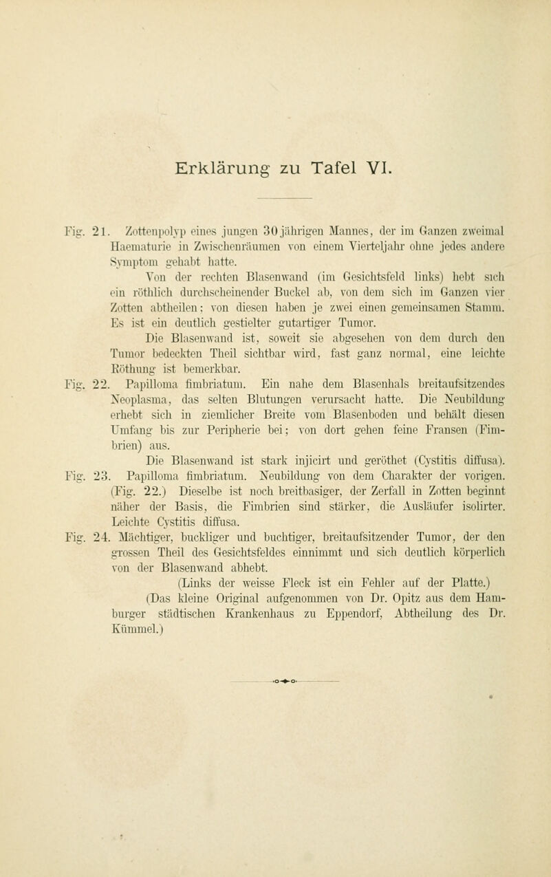 Fig. 21. Zottonpolyp eines jungen 30 jährigen Mannes, der im Ganzen zweimal Haematurie in Zwischenräumen von einem Vierteljalu- ohne jedes andere Symptom gehabt hatte. Von der rechten Blasenwand (im Gesichtsfeld links) hebt sich ein rötlilich durchscheinender Buckel ab, von dem sich im Ganzen vier Zotten abtheilen: von diesen haben je zwei einen gemeinsamen Stamm. Es ist ein deutlich gestielter gutartiger Tumor. Die Blasenwand ist, soweit sie abgesehen von dem durch den Tumor bedeckten Theil sichtbar wird, fast ganz normal, eine leichte Köthung ist liemerkbar. Fig. 22. Papilloma fimbriatum. Ein nahe dem Blasenhals breitaufsitzendes Neoplasma, das selten Blutungen verursacht hatte. Die Neubildung erhebt sich in ziemlicher Breite vom Blasenboden und beliält diesen Umfang bis zur Peripherie bei; \on dort gehen feine Fransen (Fim- brien) aus. Die Blasenwand ist stark injicirt und geröthet (Cystitis diffusa). Fig. 23. Papilloma fimbriatum. Neubildung von dem Charalrter der vorigen. (Fig. 22.) Dieselbe ist noch breitbasiger, der Zerfall in Zotten beginnt näher der Basis, die Fimbrien sind stärker, die Ausläufer isolirter. Leichte Cystitis diffusa. Fig. 24. Mächtiger, buckliger und buchtiger, breitaufsitzender Tumor, der deu grossen Theil des Gesichtsfeldes einnimmt und sich deutlich körperlich von der Blasenwand abhebt. (Links der weisse Fleck ist ein Fehler auf der Platte.) (Das kleine Original aufgenommen von Dr. Ojiitz aus dem Ham- burger städtischen Krankenhaus zu Eppendorf, Abtheilung des Di'. Kümmel.)