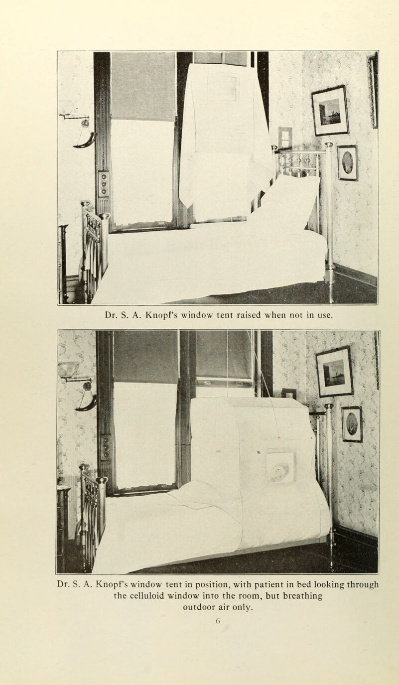 Dr. S. A. Knopf's window tent in position, with patient in bed looking through the celluloid window into the room, but breathing outdoor air only.