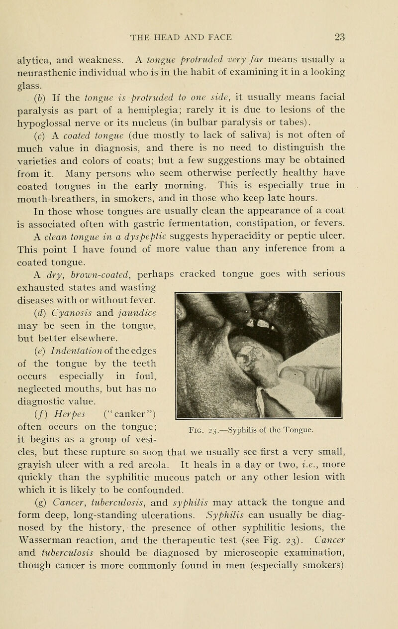 alytica, and weakness. A tongue protruded very far means usually a neurasthenic individual who is in the habit of examining it in a looking glass. (b) If the tongiie is protrtided to one side, it usually means facial paralysis as part of a hemiplegia; rarely it is due to lesions of the hypoglossal nerve or its nucleus (in bulbar paralysis or tabes). (c) A coated tongue (due mostly to lack of saliva) is not often of much value in diagnosis, and there is no need to distinguish the varieties and colors of coats; but a few suggestions may be obtained from it. Many persons who seem otherwise perfectly healthy have coated tongues in the early morning. This is especially true in mouth-breathers, in smokers, and in those who keep late hours. In those whose tongues are usually clean the appearance of a coat is associated often with gastric fermentation, constipation, or fevers. A clean tongue in a dyspeptic suggests hyperacidity or peptic ulcer. This point I have found of more value than any inference from a coated tongue. A dry, hrown-coated, perhaps cracked tongue goes with serious exhausted states and wasting diseases with or without fever. {d) Cyanosis and jaundice may be seen in the tongue, but better elsewhere. (e) Indentation of the edges of the tongue by the teeth occurs especially in foul, neglected mouths, but has no diagnostic value. (/) Herpes (canker) often occurs on the tongue; it begins as a group of vesi- cles, but these rupture so soon that we usually see first a very small, grayish ulcer with a red areola. It heals in a day or two, i.e., more quickly than the syphilitic mucous patch or any other lesion with which it is likely to be confounded. (g) Cancer, tuberculosis, and syphilis may attack the tongue and form deep, long-standing ulcerations. Syphilis can usually be diag- nosed by the history, the presence of other syphilitic lesions, the Wasserman reaction, and the therapeutic test (see Fig. 23). Cancer and tuberculosis should be diagnosed by microscopic examination, though cancer is more commonly found in men (especially smokers) Fig. 23.—Syphilis of the Tongue.