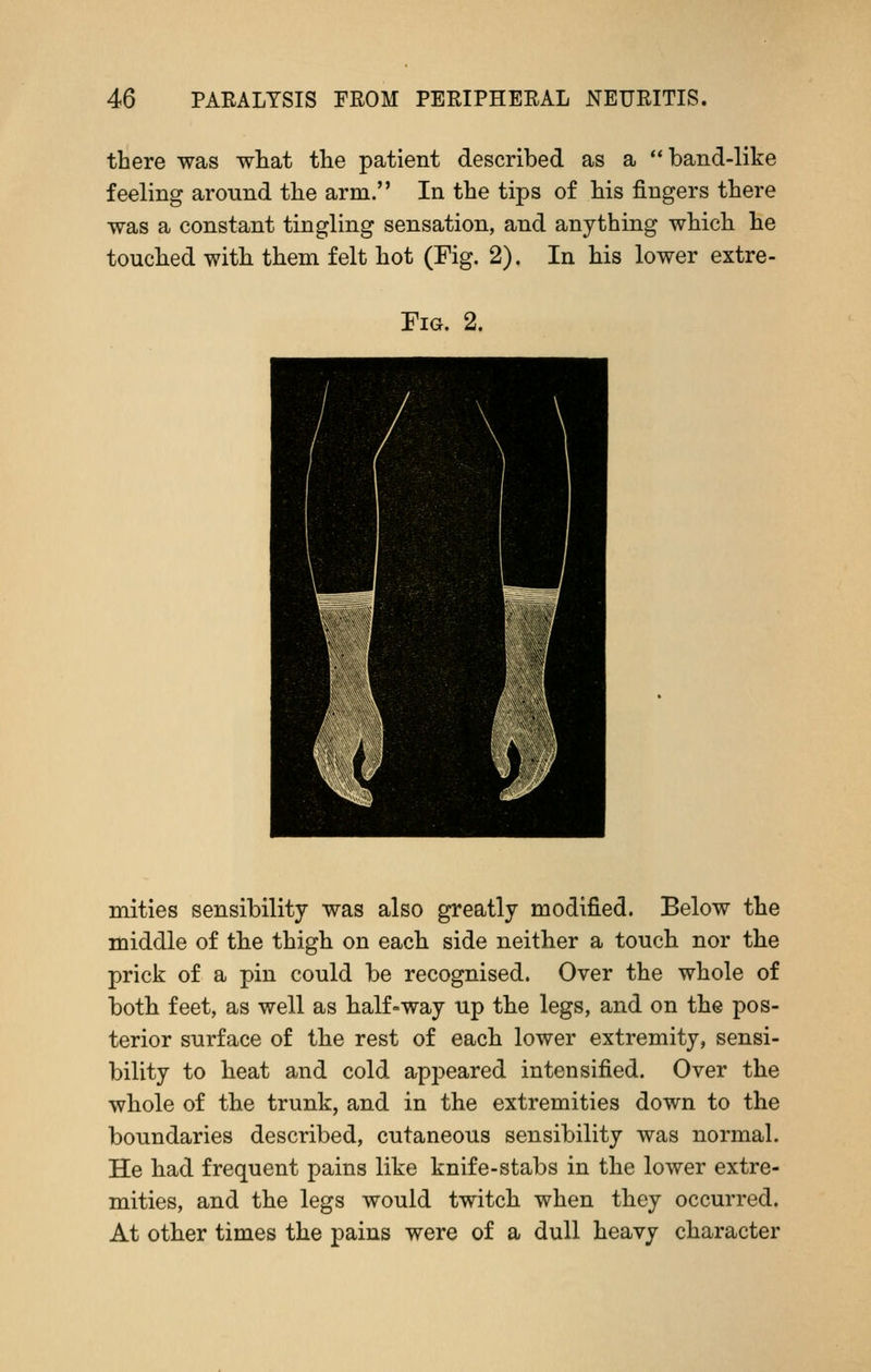 there was what the patient described as a band-like feeling around the arm. In the tips of his fingers there was a constant tingling sensation, and anything which he touched with them felt hot (Fig. 2). In his lower extre- FiG. 2. mities sensibility was also greatly modified. Below the middle of the thigh on each side neither a touch nor the prick of a pin could be recognised. Over the whole of both feet, as well as half»way up the legs, and on the pos- terior surface of the rest of each lower extremity, sensi- bility to heat and cold appeared intensified. Over the whole of the trunk, and in the extremities down to the boundaries described, cutaneous sensibility was normal. He had frequent pains like knife-stabs in the lower extre- mities, and the legs would twitch when they occurred. At other times the pains were of a dull heavy character