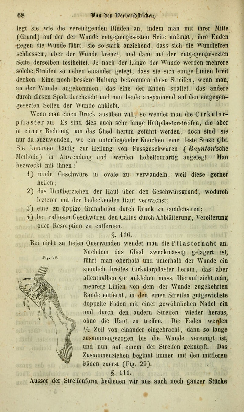 legt sie wie die vereinigenden Binden an, indem man mit ihrer Mitte (Grund) auf der der Wunde entgegengesezten Seite anfängt, ihre Enden •gegen die Wunde führt, sie so stark anziehend, dass sich die Wundlefzen schliessen, über der Wunde kreuzt, und dann auf der entgegengesezten Seite derselben festheftet. Je nach der Länge der Wunde werden mehrere solche Streifen so neben einander gelegt, dass sie sich einige Linien breit decken. Eine noch bessere Haltung bekommen diese Streifen, wenn man, an der Wunde angekommen, das eine der Enden spaltet, das andere durch diesen Spalt durchzieht und nun beide anspannend auf den entgegen- gesezten Seiten der Wunde anklebt. Wenn man einen Druck ausüben will, so wendet man die Cirkular- pflaster an. Es sind dies auch sehr lange Heftpflasterstreifen, die aber in einer Richtung um das Glied herum geführt werden, doch sind sie nur da anzuwenden, wo ein unterliegender Knochen eine feste Stüze gibt. Sie kommen häufig zur Heilung von Fussgeschwüren (JJaynton'sche Methode} in Anwendung und werden hobeltourartig angelegt. Man bezweckt mit ihnen:' 1) runde Geschwüre in ovale zu verwandeln, weil diese gerner heilen; 2} das Hinüberziehen der Haut über den Geschwürsgrund, wodurch lezterer mit der bedeckenden Haut verwächst; 3) eine zu üppige Granulation durch Druck zu condensiren; 4} bei callösen Geschwüren den Callus durch Abblätterung, Vereiterung oder Resorption zu entfernen. §. liO. Bei nicht zu tiefen Querwunden wendet man die Pflasternaht an. Nachdem das Glied zweckmässig gelagert ist, '^''' führt man oberhalb und unterhalb der Wunde ein ziemlich breites Cirkularpflaster herum, das aber allenthalben gut ankleben muss. Hierauf zieht man, mehrere Linien von dem der Wunde zugekehrten Rande entfernt, in den einen Streifen gutgewichste doppelte Fäden mit einer gewöhnlichen Nadel ein und durch den andern Streifen wieder heraus, ohne die Haut zu treffen. Die Fäden werben y^ Zoll von einander eingebracht, dann so lange zusammengezogen bis die Wunde vereinigt ist, und nun auf einem der Streifen geknüpft. Das Zusammenziehen beginnt immer mit den mittleren Fäden zuerst (Fig. 29). §• 111- Ausser der Streifenform bedienen wir uns auch noch ganzer Stücke