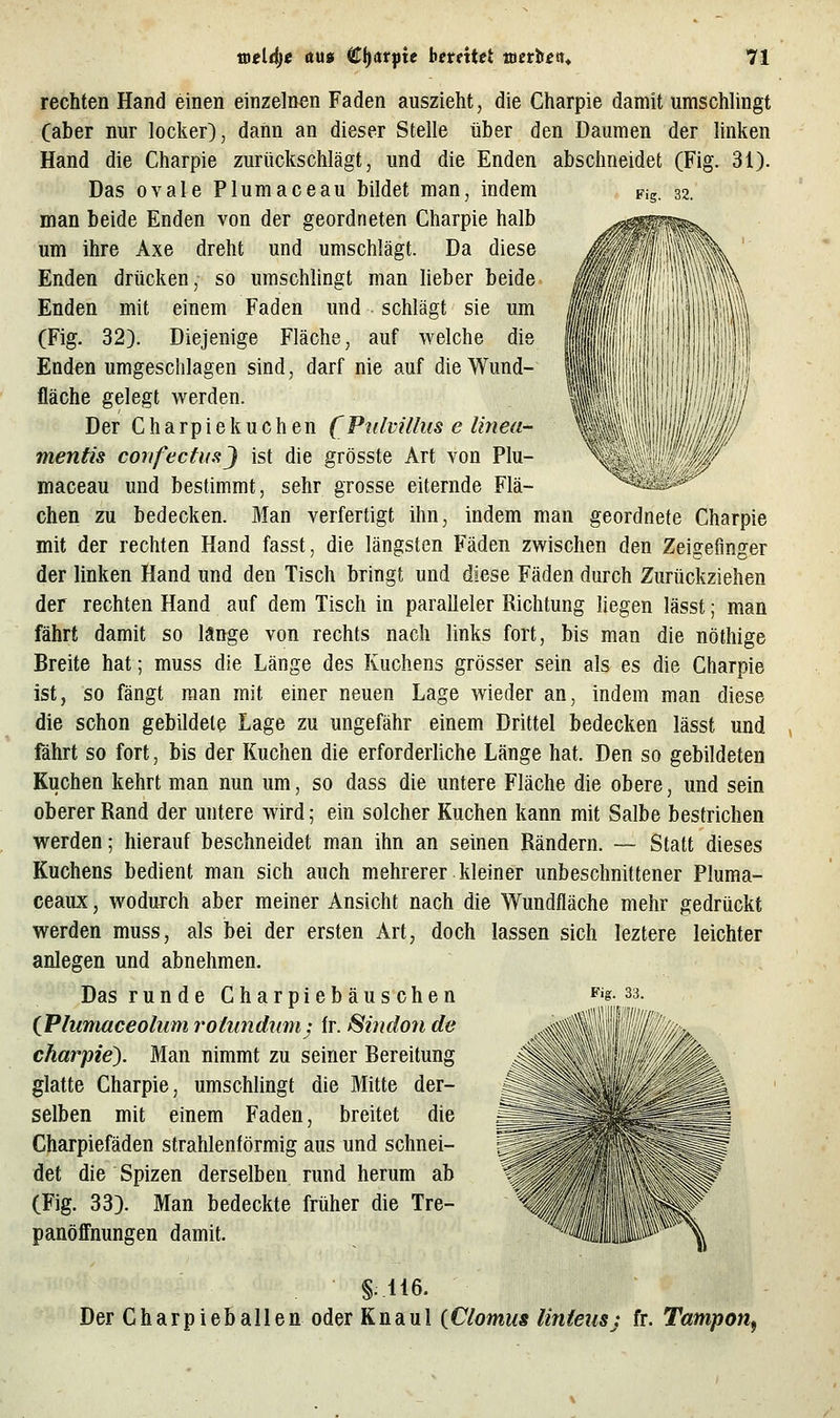 Fig. 32. rechten Hand einen einzelnen Faden auszieht, die Charpie damit umschlingt (aber nur locker), dann an dieser Stelle über den Daumen der linken Hand die Charpie zurückschlägt, und die Enden abschneidet (Fig. 31). Das ovale Plumaceau bildet man, indem man beide Enden von der geordneten Charpie halb um ihre Axe dreht und umschlägt. Da diese Enden drücken, so umschlingt man lieber beide Enden mit einem Faden und • schlägt sie um (Fig. 32). Diejenige Fläche, auf welche die Enden umgeschlagen sind, darf nie auf die Wund- fläche gelegt w^erden. Der Charpiekuchen (Pnlvillus c linea- mentis coiifecfusj ist die grösste Art von Plu- maceau und bestimmt, sehr grosse eiternde Flä- chen zu bedecken. Man verfertigt ihn, indem man geordnete Charpie mit der rechten Hand fasst, die längsten Fäden zwischen den Zeigefinger der linken Hand und den Tisch bringt und diese Fäden durch Zurückziehen der rechten Hand auf dem Tisch in paralleler Richtung liegen lässt; man fährt damit so lange von rechts nach links fort, bis man die nöthige Breite hat; muss die Länge des Kuchens grösser sein als es die Charpie ist, so fängt man mit einer neuen Lage wieder an, indem man diese die schon gebildete Lage zu ungefähr einem Drittel bedecken lässt und fährt so fort, bis der Kuchen die erforderliche Länge hat. Den so gebildeten Kuchen kehrt man nun um, so dass die untere Fläche die obere, und sein oberer Rand der untere wird; ein solcher Kuchen kann mit Salbe bestrichen werden; hierauf beschneidet man ihn an seinen Rändern. — Statt dieses Kuchens bedient man sich auch mehrerer kleiner unbeschnittener Pluma- ceaux, wodurch aber meiner Ansicht nach die Wundfläche mehr gedrückt werden muss, als bei der ersten Art, doch lassen sich leztere leichter anlegen und abnehmen. Das runde Charpiebäusehen (JPlumaceoliim rotund^im: fr. Sindoii de charpie). Man nimmt zu seiner Bereitung glatte Charpie, umschlingt die Mitte der- selben mit einem Faden, breitet die Charpiefäden strahlenförmig aus und schnei- det die Spizen derselben rund herum ab (Fig. 33). Man bedeckte früher die Tre- panöffnungen damit. Fig. 33. §^.116. Der Charpieballen oder Knaul (Clomus linieusj fr. Tampon^