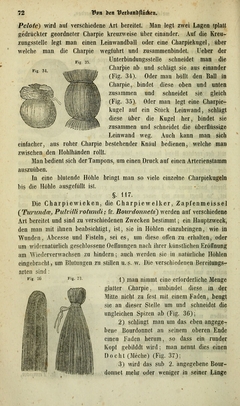 Fig. 35. Pelote) wird auf verschiedene Art bereitet. Man legt zwei Lagen fplatt gedrückter geordneter Charpie kreuzweise über einander. Auf die Kreu- zungsstelle legt man einen Leinwandball oder eine Charpiekugel, über welche man die Charpie wegftihrt und zusammenbindet. Ueber der Unterbindungsstelle schneidet man die Charpie ab und schlägt sie aus einander (Fig. 34). Oder man hyllt den Ball in Charpie., bindet diese oben und unten zusammen und schneidet sie gleich (Fig. 35). Oder man legt eine Charpie- kugel auf ein Stück Leinwand, schlägt diese über die Kugel her, bindet sie zusammen und schneidet die überflüssige Leinwand weg. Auch kann man sich einfacher, aus roher Charpie bestehender Knaul bedienen, welche man zwischen den Hohlhänden rollt. Man bedient sich der Tampons, um einen Druck auf einen Arterienstamm auszuüben. In eine blutende Höhle bringt man so viele einzelne Charpiekugeln bis die Höhle ausgefüllt ist. §. 117. Die Charpiewieken, die Charpiewelker, Zapfenmeissel (Turund(Bj, Pulvilli rotundi; fr. Bourdoiinels') werden auf verschiedene Art bereitet und sind zu verschiedenen Zwecken bestimmt; ein Hauptzweck, den man mit ihnen beabsichtigt, ist, sie in Höhlen einzubringen, wie in Wunden, Abcesse und Fisteln, sei es, um diese offen zu erhalten, oder um widernatürUch geschlossene Oelfnungen nach ihrer künstUchen Eröffnung am Wiederverwachsen zu hindern; auch werden sie in natürliche Höhlen eingebracht, um Blutungen zu stillen u. s. w. Die verschiedenen Bereitungs- arten sind: 1) man nimmt eine erforderliche Menge glatter Charpie, umbindet diese in der Mitte nicht zu fest mit einem Faden, beugt sie an dieser Stelle um und schneidet die ungleichen Spizen ab (Fig. 36); 2) schlingt man um das eben angege- bene Bourdonnet an seinem oberen Ende emen Faden herum, so dass ein runder Kopf gebilddt wird; man nennt dies einen Docht (Meche) (Fig. 37); 3) wird das sub 2. angegebene Bour- donnet mehr oder weniger in seiner Länge Fig. 36 Fis. 73.