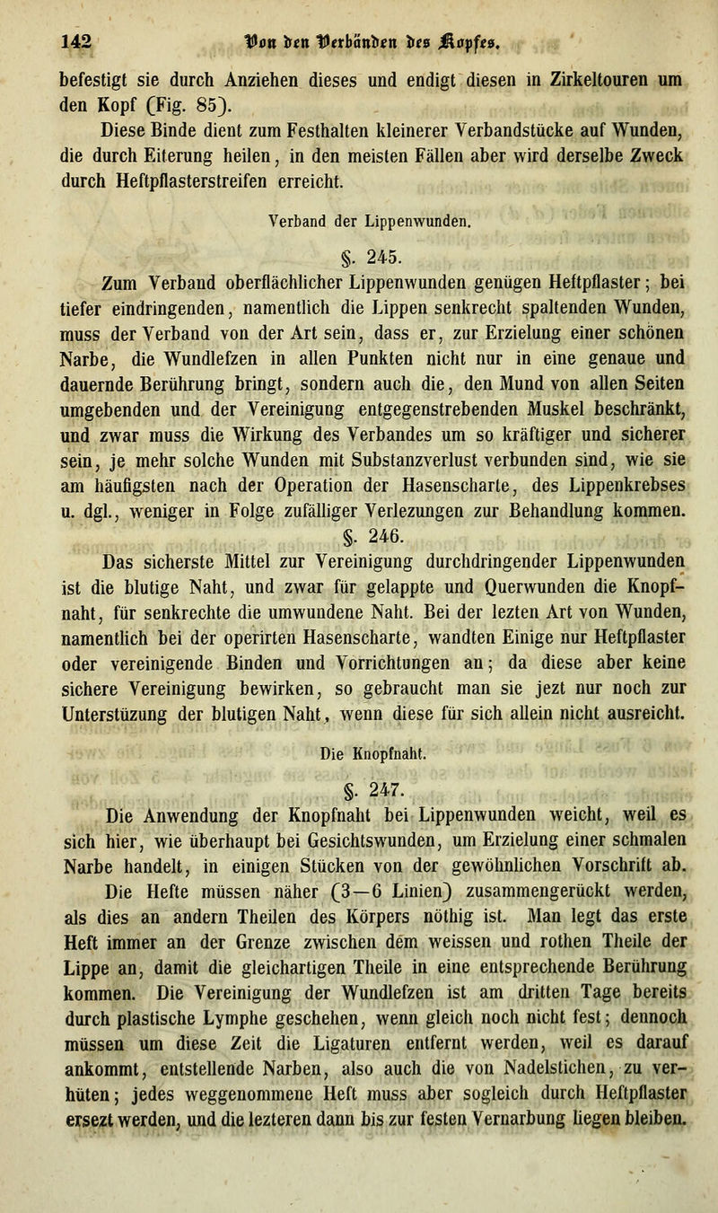 befestigt sie durch Anziehen dieses und endigt diesen in Zirkeltouren um den Kopf (Fig. 85). Diese Binde dient zum Festhalten kleinerer Verbandstücke auf Wunden, die durch Eiterung heilen, in den meisten Fällen aber wird derselbe Zweck durch Heftpflasterstreifen erreicht. Verband der Lippenwunden. §. 245. Zum Verband oberflächlicher Lippenwunden genügen Heftpflaster; bei tiefer eindringenden, namentlich die Lippen senkrecht spaltenden Wunden, muss der Verband von der Art sein, dass er, zur Erzielung einer schönen Narbe, die Wundlefzen in allen Punkten nicht nur in eine genaue und dauernde Berührung bringt, sondern auch die, den Mund von allen Seiten umgebenden und der Vereinigung entgegenstrebenden Muskel beschränkt, und zwar muss die Wirkung des Verbandes um so kräftiger und sicherer sein, je mehr solche Wunden mit Substanzverlust verbunden sind, wie sie am häufigsten nach der Operation der Hasenscharte, des Lippenkrebses u. dgl., weniger in Folge zufälliger Verlezungen zur Behandlung kommen. §. 246. Das sicherste Mittel zur Vereinigung durchdringender Lippenwunden ist die blutige Naht, und zwar für gelappte und Querwunden die Knopf- naht, für senkrechte die umwundene Naht. Bei der lezten Art von Wunden, namenthch bei der operirten Hasenscharte, wandten Einige nur Heftpflaster oder vereinigende Binden und Vorrichtungen an; da diese aber keine sichere Vereinigung bewirken, so gebraucht man sie jezt nur noch zur Unterstüzung der blutigen Naht, wenn diese für sich allein nicht ausreicht. Die Knopfnaht. §. 247. Die Anwendung der Knopfnaht bei Lippenwunden weicht, weil es sich hier, wie überhaupt bei Gesichtswunden, um Erzielung einer schmalen Narbe handelt, in einigen Stücken von der gewöhnUchen Vorschrift ab. Die Hefte müssen näher (3—6 Linien) zusammengerückt werden, als dies an andern Theilen des Körpers nöthig ist. Man legt das erste Heft immer an der Grenze zwischen dem weissen und rothen Theile der Lippe an, damit die gleichartigen Theile in eine entsprechende Berührung kommen. Die Vereinigung der Wundlefzen ist am dritten Tage bereits durch plastische Lymphe geschehen, wenn gleich noch nicht fest; dennoch müssen um diese Zeit die Ligaturen entfernt werden, weil es darauf ankommt, entstellende Narben, also auch die von Nadelstichen, zu ver- hüten; jedes weggenommene Heft muss aber sogleich durch Heftpflaster ersezt werden, und die lezteren dann bis zur festen Vernarbung hegen bleiben.