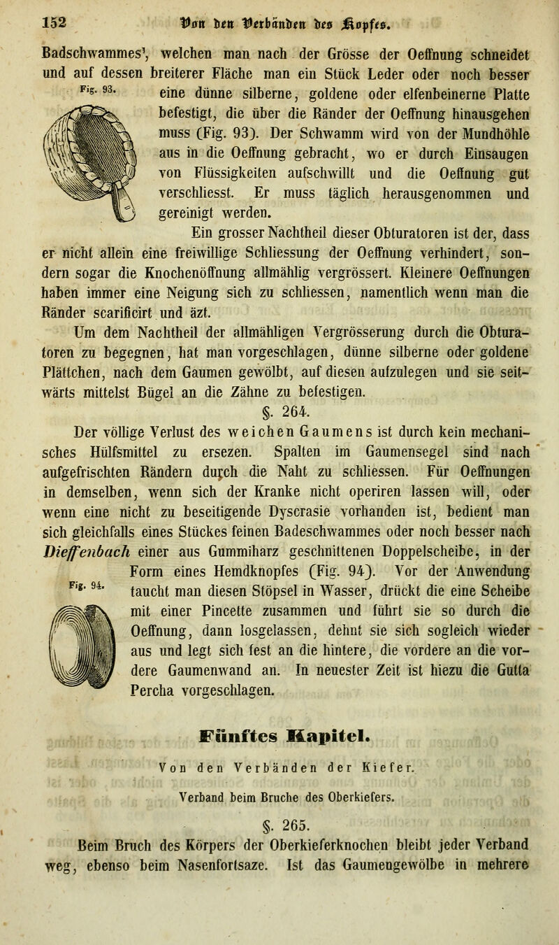 Badschwammes', welchen man nach der Grösse der Oeffnung schneidet und auf dessen breiterer Fläche man ein Stück Leder oder noch besser Fig. 93. ejjje dünne silberne, goldene oder elfenbeinerne Platte befestigt, die über die Ränder der Oeffnung hinausgehen muss (Fig. 93). Der Schwamm wird von der Mundhölile VW^^^^H ^^ ^^ ^^^ Oeffnung gebracht, wo er durch Einsaugen ' ^' ^ ' ^' ' von Flüssigkeiten aufschwillt und die Oeffnung gut verschliesst. Er muss täglich herausgenommen und gereinigt werden. Ein grosser Nachtheil dieser Obturatoren ist der, dass er nicht allein eine freiwillige Schliessung der Oeffnung verhindert, son- dern sogar die Knochenöffnung allmäWig vergrössert. Kleinere Oeffnungen haben immer eine Neigung sich zu scMiessen, namentlich wenn man die Ränder scarificirt und äzt. Um dem Nachtheil der allmähligen Vergrösserung durch die Obtura- toren zu begegnen, hat man vorgeschlagen, dünne silberne oder goldene Plättchen, nach dem Gaumen gewölbt, auf diesen aufzulegen und sie seit- wärts mittelst Bügel an die Zähne zu befestigen. §. 264. Der völlige Verlust des weichen Gaumens ist durch kein mechani- sches Hülfsmittel zu ersezen. Spalten im Gaumensegel sind nach aufgefrischten Rändern dujch die Nalit zu schliessen. Für Oeffnungen in demselben, wenn sich der Kranke nicht operiren lassen will, oder wenn eine nicht zu beseitigende Dyscrasie vorhanden ist, bedient man sich gleichfalls eines Stückes feinen Badeschwammes oder noch besser nach Dieffenbach einer aus Gummiharz geschnittenen Doppelscheibe, in der Form eines Hemdknopfes (Fig. 94}. Vor der Anwendung taucht man diesen Stöpsel in Wasser, drückt die eine Scheibe mit einer Pincette zusammen und führt sie so durch die Oeffnung, dann losgelassen, dehnt sie sich sogleich wieder aus und legt sich fest an die hintere, die vordere an die vor- dere Gaumenwand an. In neuester Zeit ist hiezu die Gutta Percha vorgescMagen. Fig. 94. Fünftes Kapitel. ' VoD den Verbänden der Kiefer. Verband beim Bruche des Oberkiefers. §. 265. Beim Bruch des Körpers der Oberkieferknochen bleibt jeder Verband weg, ebenso beim Nasenfortsaze. Ist das Gaumengewölbe in mehrere