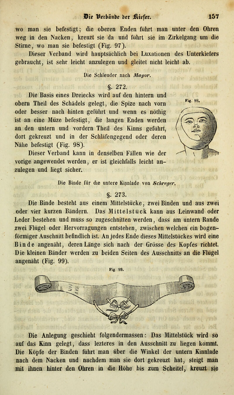 wo man sie befestigt; die oberen Enden führt man unter den Ohren weg in den Nacken, kreuzt sie da und führt sie im Zirkelgang um die Stirne, wo man sie befestigt (Fig. 97). Dieser Verband wird hauptsächlich bei Luxationen des Unterkiefers gebraucht, ist sehr leicht anzulegen und gleitet nicht leicht ab. Die Schleuder nach Mayor. §. 272. Die Basis eines Dreiecks wird auf den hintern und obern Theil des Schädels gelegt, die Spize nach vorn oder besser nach hinten geführt und wenn es nöthig ist an eine Müze befestigt, die langen Enden werden an den untern und vordem Theil des Kinns geführt, dort gekreuzt und in der Schläfengegend oder deren Nähe befestigt (Fig. 98). Dieser Verband kann in denselben Fällen wie der vorige angewendet werden, er ist gleichfalls leicht an- zulegen und liegt sicher. Die Binde für die untere Kinnlade von Schreger. §. 273. Die Binde besteht aus einem Mittelstücke, zwei Binden und aus zwei oder vier kurzen Bändern. Das Mittelstück kann aus Leinwand oder Leder bestehen und muss so zugeschnitten werden, dass am untern Rande zwei Flügel oder Hervorragungen entstehen, zwischen welchen ein bogen- förmiger Anschnitt beflndUch ist. An jedes Ende dieses Mittelstückes wird eine Binde angenäht, deren Länge sich nach der Grösse des Kopfes richtet. Die kleinen Bänder werden zu beiden Seiten des Ausschnitts an die Flügel angenäht (Fig. 99). Fig. 99. Die Anlegung geschieht folgendermassen: Das Mittelstück wird so auf das Kinn gelegt, dass lezteres in den Ausschnitt zu liegen kommt. Die Köpfe der Binden führt man über die Winkel der untern Kinnlade nach dem Nacken und nachdem man sie dort gekreuzt hat, steigt man mit ihnen hinter den Ohren in die Höhe bis zum Scheitel, kreuzt sie