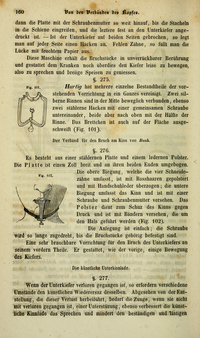 Fig. 101. dann die Platte mit der Schraubenmutter so weit hinauf, bis die Stacheln in die Schiene eingreifen, und die leztere fest an den Unterkiefer ange- drückt ist. —Ist der Unterkiefer auf beiden Seiten gebrochen, so legt man auf jeder Seite einen Hacken an. Fehlen Zähne, so füllt man die Lücke mit feuchtem Papier aus. Diese Maschine erhält die Bruchstücke in unverrückbarer Berührung und gestattet dem Kranken noch überdies den Kiefer leise zu bewegen, also zu sprechen und breiige Speisen zu gemessen. §. 275. Hurtig hat mehrere einzelne Bestandtheile der vor- stehenden Vorrichtung in ein Ganzes vereinigt. Zwei sil- berne Rinnen sind in der Mitte beweglich verbunden, ebenso zwei stählerne Hacken mit einer gemeinsamen Schraube untereinander, beide aber nach oben mit der Hälfte der Rinne. Das Brettchen ist auch auf der Fläche ausge- schweift (Fig. 101). Uer Verband für den Bruch am Kinn von Bush. %. 276. Es besteht aus einer stälilernen Platte und einem ledernen Polster. Die Platte ist einen Zoll breit und an ihren beiden Enden umgebogen. Die obere Biegung, welche die vier Schneide- zähne umfasst, ist mit Rosshaaren gepolstert und mit Handschuhleder überzogen; die untere Biegung umfasst das Kinn und ist mit einer Schraube und Schraubenmutter versehen. Das Polster dient zum Schuz des Kinns gegen Druck und ist mit Bändern versehen, die um den Hals geführt werden (Fig. 102). Die Anlegung ist einfach; die Schraube wird so lange zugedreht, bis die Bruchstücke gehörig befestigt sind. Eine sehr brauchbare Yorrichtung für den Bruch des Unterkiefers an seinem vordem Theile. Er gestattet, wie der vorige, einige Bewegung des Kiefers, Fig. 102. Die künstliche ünterkinnlade. §. 277. Wenn der Unterkiefer verloren gegangen ist, so erfordern verschiedene Umstände den künstlichen Wiederersaz desselben. Abgesehen von der Ent- stellung, die dieser Verlust herbeiführt, bedarf die Zunge, wenn sie nicht mit verloren gegangen ist, einer Unterstüzung, ebenso verbessert die künst- liche Kinnlade das Sprechen und mindert den beständigen und lästigen