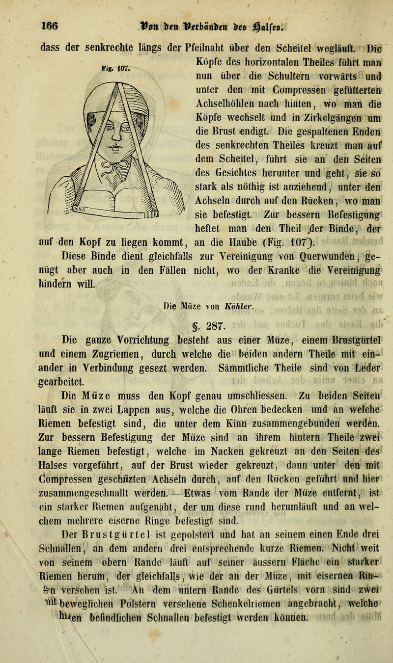 Kg. lor. dass der senkrechte längs der Pfeilnaht über den Scheitel wegläuft. Die Köpfe des horizontalen Theiles führt man nun über die Schultern vorwärts und unter den mit Compressen gefütterten Achselhöhlen nach hinten, wo man die Köpfe wechselt und in Zirkelgängen um die Brust endigt. Die gespaltenen Enden des senkrechten Theiles kreuzt man auf dem Scheitel, führt sie an den Seiten des Gesichtes herunter und geht, sie so stark als nöthig ist anziehend, unter den Achseln durch auf den Rücken, wo man sie befestigt. Zur bessern Befestigung heftet man den Theil .der Binde, der auf den Kopf zu liegen kommt, an die Haube (Fig. 407). j^' Diese Binde dient gleichfalls zur Yereinigung von Querwunden, ge- nügt aber auch in den Fällen nicht, wo der Kranke die Vereinigung hindern will. Die Müze von Köhler. „,. §. 287. Sil)* Die ganze Vorrichtung besteht aus einer Müze, einem Brustgürtel und einem Zugriemen, durch welche die beiden andern Theile mit ein- ander in Verbindung gesezt werden. Sämmtliche Theile sind von Leder gearbeitet. iJ' -«^flw uh Die Müze muss den Kopf genau umschliessen. Zu beidenSiÄfeli' läuft sie in zwei Lappen aus, welche die Ohren bedecken und an welche Riemen befestigt sind, die unter dem Kinn zusammengebunden werden. Zur bessern Befestigung der Müze sind an ihrem hintern Theile zwei lange Riemen befestigt, welche im Nacken gekreuzt an den Seiten des Halses vorgeführt, auf der Brust wieder gekreuzt, dann unter den mit Compressen geschüzten Achseln durch, auf den Rücken geführt und hier zusammengeschnallt werden.—Etwas vom Rande der Müze entfernt, ist ein starker Riemen aufgenäht, der um diese rund herumläuft und an wel- chem mehrere eiserne Ringe befestigt sind. Der Brustgürtel ist gepolstert und hat an seinem einen Ende drei Schnallen, an dem andern drei entsprechende kurze Riemen. Nicht weit von seinem obern Rande läuft auf seiner äussern Fläche ein starker Riemen herum, der gleichfalls, wie der an der Müze, mit eisernen Rin- bn versehen ist. An dem untern Rande des Gürtels vorn sind zwei ^it beweghchen Polstern versehene Schenkelriemen angebracht, welche hMen befindlichen Schnallen befestigt werden können. '• *W»16