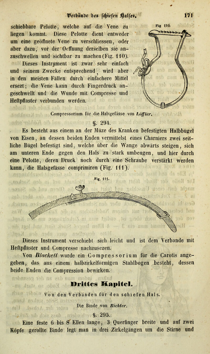 Fig HO. schiebbare Pelotte, welche auf die Vene zu liegen kommt. Diese Pelotte dient entweder um eine geöffnete Vene zu verschliessen, oder aber dazu, vor der Oeffnung derselben sie an- zuschwellen und sichtbar zu machen CFig. HO). Dieses Instrument ist zwar sehr einfach und seinem Zwecke entsprechend wird aber in den meisten Fällen durch einfachere Mittel ersezt; die Vene kann durch Fingerdruck an- geschwellt und die Wunde mit Compresse und Heftpflaster verbunden werden. Compressorium für die Halsgefässe von Löffler, §. 294. Es besteht aus einem an der Müze des Kranken befestigten Halbbügel von Eisen, an dessen beiden Enden vermittelst eines Gharniers zwei seit- liche Bügel befestigt sind, welche über die Wange abwärts steigen, sich am unteren Ende gegen den Hals zu stark umbeugen, und hier durch eine Pelotte, deren Druck noch durch eine Schraube verstärkt werden kann, die Halsgefässe comprimiren (Fig. 111}. Fig. 1(1 'A oj'J Dieses Instrument verschiebt sich leicht und ist dem Verbände mit Heftpflaster und Compresse nachzusezen. Von Blackell wurde ein Compressorium für die Carotis ange- geben, das aus einem halbziikelförmigen Stahlbogen besteht, dessen beide Enden die Compression bewirken. 4,,jj Dritteis Kapitel* VÖ'ri' den Verbänden für den schiefen Hals. Die Binde von Richter. §. 295. Eine feste 6 bis 8 Ellen lange, 3 Querfinger breite und auf zwei Köpfe gerollte Binde legt man in drei Zirkelgängen um die Stirne und
