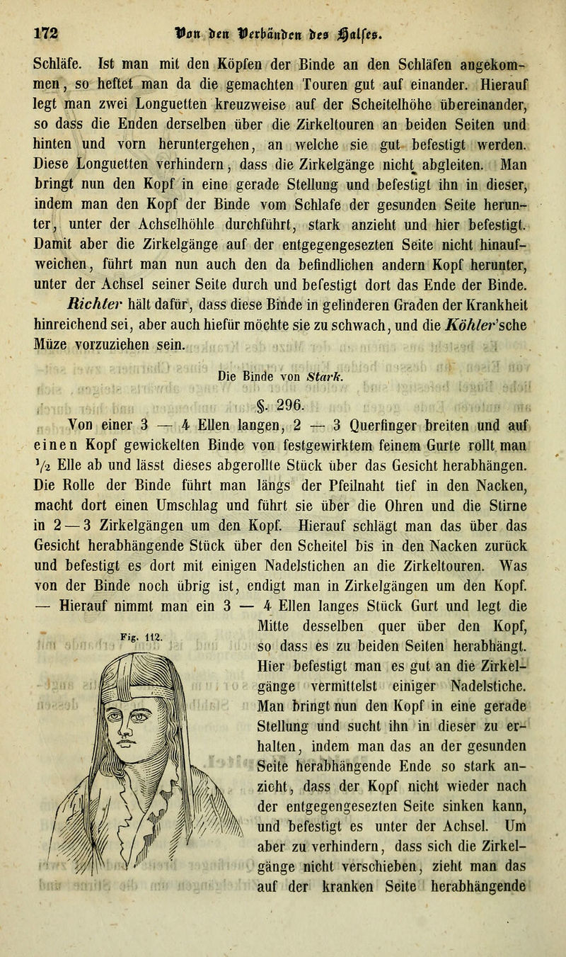 Schläfe. Ist man mit den Köpfen der Binde an den Schläfen angekom- men, so heftet man da die gemachten Touren gut auf einander. Hierauf legt man zwei Longuetten kreuzweise auf der Scheitelhöhe übereinander, so dass die Enden derselben über die Zirkeltouren an beiden Seiten und hinten und vorn heruntergehen, an welche sie gut befestigt werden. Diese Longuetten verhindern, dass die Zirkelgänge nicht^ abgleiten. Man bringt nun den Kopf in eine gerade Stellung und befestigt ihn in dieser, indem man den Kopf der Binde vom Schlafe der gesunden Seite herun- ter, unter der Achselhöhle durchführt, stark anzieht und hier befestigt. Damit aber die Zirkelgänge auf der entgegengesezten Seite nicht hinauf- weichen, führt man nun auch den da befindlichen andern Kopf herunter, unter der Achsel seiner Seite durch und befestigt dort das Ende der Binde. Richter hält dafür, dass diese Binde in gelinderen Graden der Krankheit hinreichend sei, aber auch hiefür möchte sie zu schwach, und die Köhlei^'sche Müze vorzuziehen sein. Die Binde von Stark. §. 296. Von einer 3 — 4 Ellen langen, 2 — 3 Querfinger breiten und auf einen Kopf gewickelten Binde von festgewirktem feinem Gurte rollt man V2 Elle ab und lässt dieses abgerollte Stück über das Gesicht herabhängen. Die Rolle der Binde führt man längs der Pfeilnaht tief in den Nacken, macht dort einen Umschlag und führt sie über die Ohren und die Stirne in 2 —3 Zirkelgängen um den Kopf. Hierauf schlägt man das über das Gesicht herabhängende Stück über den Scheitel bis in den Nacken zurück und befestigt es dort mit einigen Nadelstichen an die Zirkeltouren. Was von der Binde noch übrig ist, endigt man in Zirkelgängen um den Kopf. — Hierauf nimmt man ein 3 — 4 Ellen langes Stück Gurt und legt die Mitte desselben quer über den Kopf, so dass es zu beiden Seiten herabhängt. Hier befestigt man es gut an die Zirkel-' gänge vermittelst einiger Nadelstiche. Man bringt nun den Kopf in eine gerade Stellung und sucht ihn in dieser zu er- halten, indem man das an der gesunden Seite herabhängende Ende so stark an- zieht, dass der Kopf nicht wieder nach der entgegengesezten Seite sinken kann, und befestigt es unter der Achsel. Um aber zu verhindern, dass sich die Zirkel- gänge nicht verschieben, zieht man das rdiiic auf der kranken Seite herabhängende