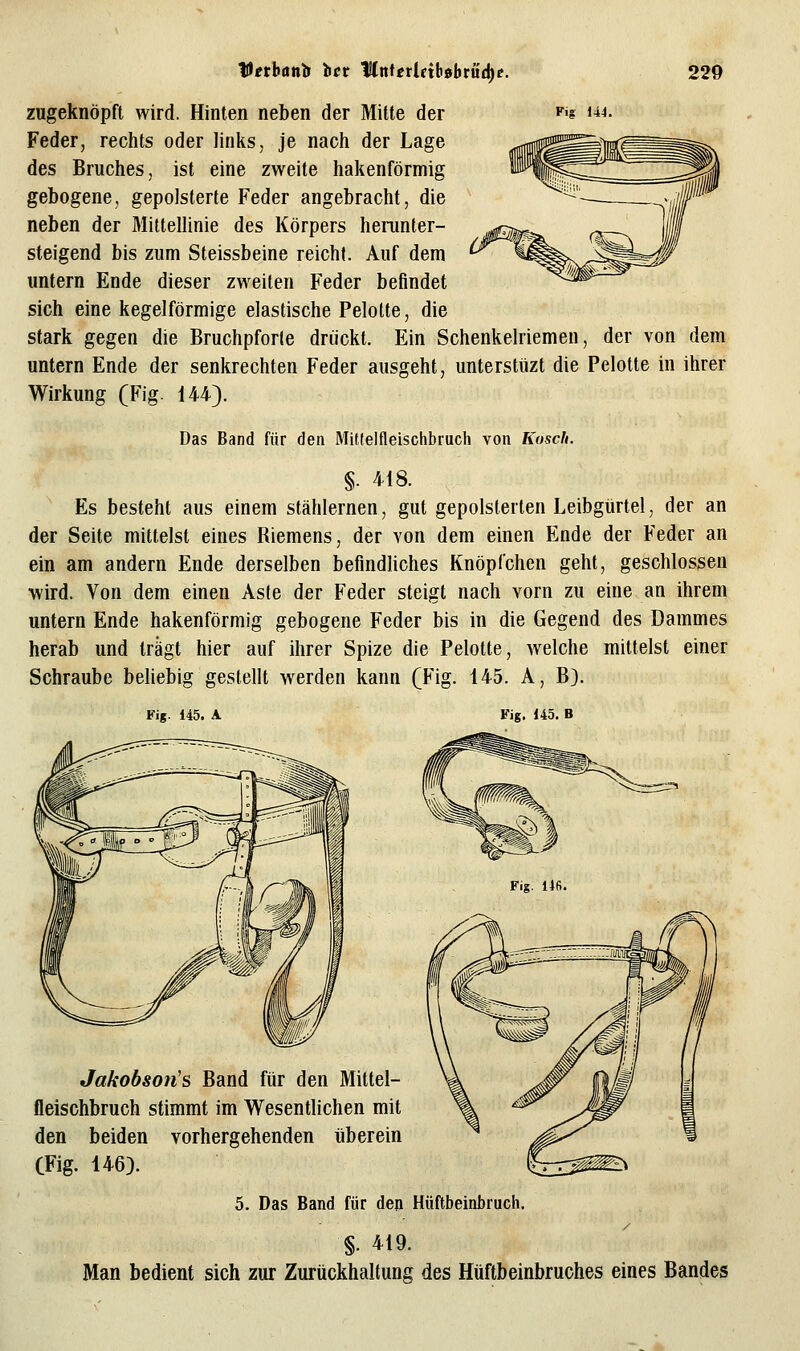 zugeknöpft wird. Hinten neben der Mitte der ^'s i**- Feder, rechts oder links, je nach der Lage des Bruches, ist eine zweite hakenförmig gebogene, gepolsterte Feder angebracht, die neben der Mittellinie des Körpers herunter- steigend bis zum Steissbeine reicht. Auf dem untern Ende dieser zweiten Feder befindet sich eine kegelförmige elastische Pelotte, die stark gegen die Bruchpforte drückt. Ein Schenkelriemen, der von dem untern Ende der senkrechten Feder ausgeht, unterstüzt die Pelotte in ihrer Wirkung (Fig. 144). Das Band für den Miffelfleischbruch von Koscli. §. 418. Es besteht aus einem stählernen, gut gepolsterten Leibgiirtel, der an der Seite mittelst eines Riemens, der von dem einen Ende der Feder an ein am andern Ende derselben befindliches Knöpfchen geht, geschlossen wird. Von dem einen Aste der Feder steigt nach vorn zu eine an ihrem untern Ende hakenförmig gebogene Feder bis in die Gegend des Dammes herab und trägt hier auf ihrer Spize die Pelotte, welche mittelst einer Schraube behebig gestellt werden kann (Fig. 145. A, B). Fig. 145. A Fig. 145. B Jakobson's Band für den Mittel- fleischbruch stimmt im Wesentlichen mit den beiden vorhergehenden überein CFig. 146). 5. Das Band für den Hüftbeinbruch. §. 419. Man bedient sich zur Zurückhaltung des Hüftbeinbruches eines Bandes