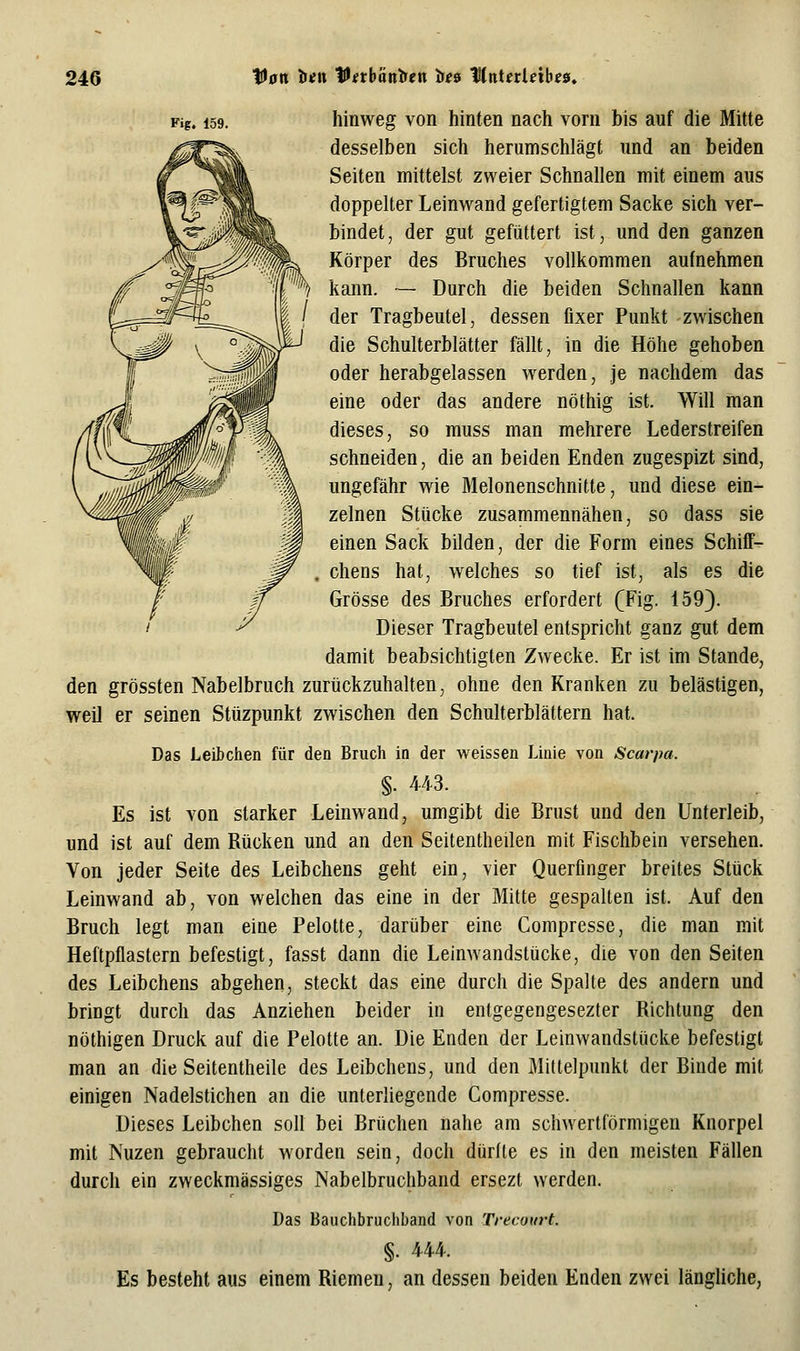 24G Van !><« Vnhantien ir^s Mnletletbes^ Fif. 159. hinweg von hinten nach vorn bis auf die Mitte desselben sich herumschlägt und an beiden Seiten mittelst zweier Schnallen mit einem aus doppelter Leinwand gefertigtem Sacke sich ver- bindet, der gut gefüttert ist, und den ganzen Körper des Bruches vollkommen aufnehmen kann. — Durch die beiden Schnallen kann der Tragbeutel, dessen fixer Punkt zwischen die Schulterblätter fällt, in die Höhe gehoben oder herabgelassen werden, je nachdem das eine oder das andere nöthig ist. Will man dieses, so muss man mehrere Lederstreifen schneiden, die an beiden Enden zugespizt sind, ungefähr wie Melonenschnitte, und diese ein- zelnen Stücke zusammennähen, so dass sie einen Sack bilden, der die Form eines Schiff-^ chens hat, welches so tief ist, als es die Grösse des Bruches erfordert (Fig. 159). Dieser Tragbeutel entspricht ganz gut dem damit beabsichtigten Zwecke. Er ist im Stande, den grössten Nabelbruch zurückzuhalten, ohne den Kranken zu belästigen, weil er seinen Stüzpunkt zwischen den Schulterblättern hat. Das LeiJbchen für den Bruch in der weissen Linie von Scarpa. §. 443. Es ist von starker Leinwand, umgibt die Brust und den Unterleib, und ist auf dem Rücken und an den Seitentheilen mit Fischbein versehen. Von jeder Seite des Leibchens geht ein, vier Querfinger breites Stück Leinwand ab, von welchen das eine in der Mitte gespalten ist. Auf den Bruch legt man eine Pelotte, darüber eine Compresse, die man mit Heftpflastern befestigt, fasst dann die Leinwandstücke, die von den Seiten des Leibchens abgehen, steckt das eine durch die Spalte des andern und bringt durch das Anziehen beider in enigegengesezter Richtung den nöthigen Druck auf die Pelotte an. Die Enden der Leinwandstücke befestigt man an die Seitentheile des Leibchens, und den Mittelpunkt der Binde mit einigen Nadelstichen an die unterliegende Compresse. Dieses Leibchen soll bei Brüchen nahe am schwertförmigen Knorpel mit Nuzen gebraucht worden sein, doch dürfte es in den meisten Fällen durch ein zweckmässiges Nabelbruchband ersezt werden. Das Bauclibruchband von Trecourt. §. 444. Es besteht aus einem Riemen, an dessen beiden Enden zwei längliche,