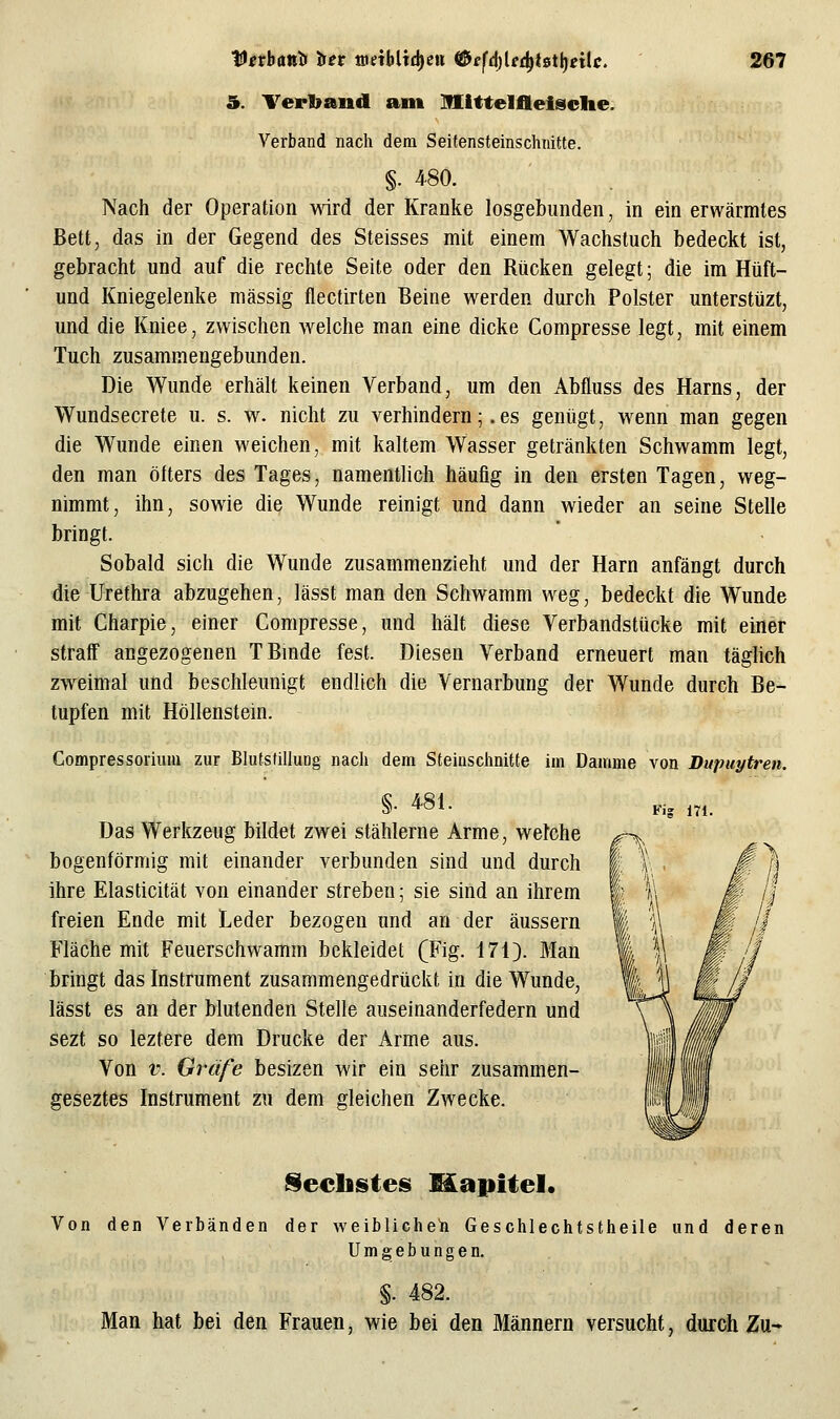 5. Verband ant Mlttelfleisclie. Verband nach dem Seitensteinschnitte. §. 480. Nach der Operation wird der Kranke losgebunden, in ein erwärmtes Bett, das in der Gegend des Steisses mit einem Wachstuch bedeckt ist, gebracht und auf die rechte Seite oder den Rücken gelegt; die im Hüft- und Kniegelenke massig flectirten Beine werden durch Polster unterstüzt, und die Kniee, zwischen welche man eine dicke Compresse legt, mit einem Tuch zusammengebunden. Die Wunde erhält keinen Verband, um den Abfluss des Harns, der Wundsecrete u. s. w. nicht zu verhindern;.es gentigt, wenn man gegen die Wunde einen weichen, mit kaltem Wasser getränkten Schwamm legt, den man öfters des Tages, namentlich häufig in den ersten Tagen, weg- nimmt, ihn, sowie die Wunde reinigt und dann wieder an seine Stelle bringt. Sobald sich die Wunde zusammenzieht und der Harn anfängt durch die Urethra abzugehen, lässt man den Schwamm weg, bedeckt die Wunde mit Gharpie, einer Compresse, und hält diese Verbandstücke mit einer straff angezogenen TBmde fest. Diesen Verband erneuert man täglich zweimal und beschleunigt endlich die Vernarbung der Wunde durch Be- tupfen mit Höllenstein. Compressorium zur Blutstillung nach dem Steiuschnitte im Damme von Dupuytren. §. 481. Das Werkzeug bildet zwei stählerne Arme, welche bogenförmig mit einander verbunden sind und durch ihre Elasticität von einander streben; sie sind an ihrem freien Ende mit Leder bezogen und an der äussern Fläche mit Feuerschwamm bekleidet (Fig. 171). Man bringt das Instrument zusammengedrückt in die Wunde, lässt es an der blutenden Stelle auseinanderfedern und sezt so leztere dem Drucke der Arme aus. Von V. Gräfe besizen wir ein sehr zusammen- geseztes Instrument zu dem gleichen Zwecke. Kig 171. Ideellstes Mapitel* Von den Verbänden der weibliche^ Geschlechtstheile und deren Umgebungen. §. 482. Man hat bei den Frauen, wie bei den Männern versucht, durch Zu-
