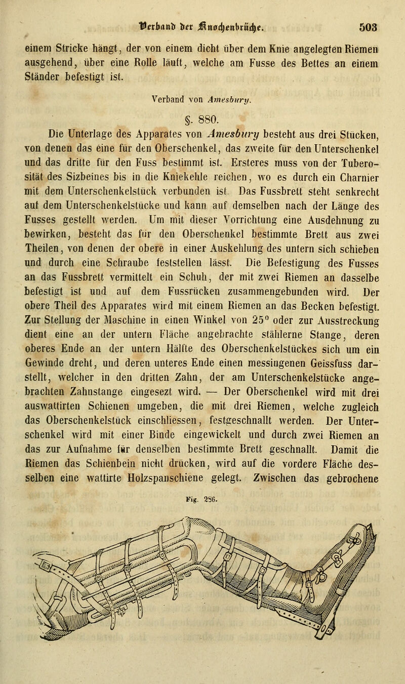 einem Stricke hängt, der von einem dicht über dem Knie angelegten Riemen ausgehend, über eine Rolle läuft, welche am Fusse des Bettes an einem Ständer befestigt ist. Verband von Amesbitry. §. 880. Die Unterlage des Apparates von Amesbury besteht aus drei Stücken, von denen das eine für den Oberschenkel, das zweite für den Unterschenkel und das dritte für den Fuss bestimmt ist. Ersteres muss von der Tubero- sität des Sizbeines bis in die Kniekehle reichen, wo es durch ein Charnier mit dem Unterschenkelstück verbunden ist Das Fussbrett steht senkrecht aut dem Unterschenkelstücke und kann auf demselben nach der Länge des Fusses gestellt werden. Um mit dieser Vorrichtung eine Ausdehnung zu bewirken, besteht das fiir den Oberschenkel bestimmte Brett aus zwei Theilen, von denen der obere in einer Auskehlung des untern sich schieben und durch eine Schraube teststellen lässt. Die Befestigung des Fusses an das Fussbrett vermittelt ein Schuh, der mit zwei Riemen an dasselbe befestigt ist und auf dem Fussrücken zusammengebunden wird. Der obere Theil des Apparates wird mit einem Riemen an das Becken befestigt. Zur Stellung der Maschine in einen Winkel von 25 oder zur Ausstreckung dient eine an der untern Fläche angebrachte stählerne Stange, deren oberes Ende an der untern Hälfte des Oberschenkelstückes sich um ein Gewinde dreht, und deren unteres Ende einen messingenen Geissfuss dar- stellt, welcher in den dritten Zahn, der am Unterschenkelstücke ange- brachten Zahnstange eingesezt wird. — Der Oberschenkel wird mit drei auswattirten Schienen umgeben, die mit drei Riemen, welche zugleich das Oberschenkelstück einschliessen, festgeschnallt werden. Der Unter- schenkel wird mit einer Binde eingewickelt und durch zwei Riemen an das zur Aufnahme für denselben bestimmte Brett geschnallt. Damit die Riemen das Schienbein nicht drücken, wird auf die vordere Fläche des- selben eine wattirte Holzspanschiene gelegt. Zwischen das gebrochene Fig. 2S6.