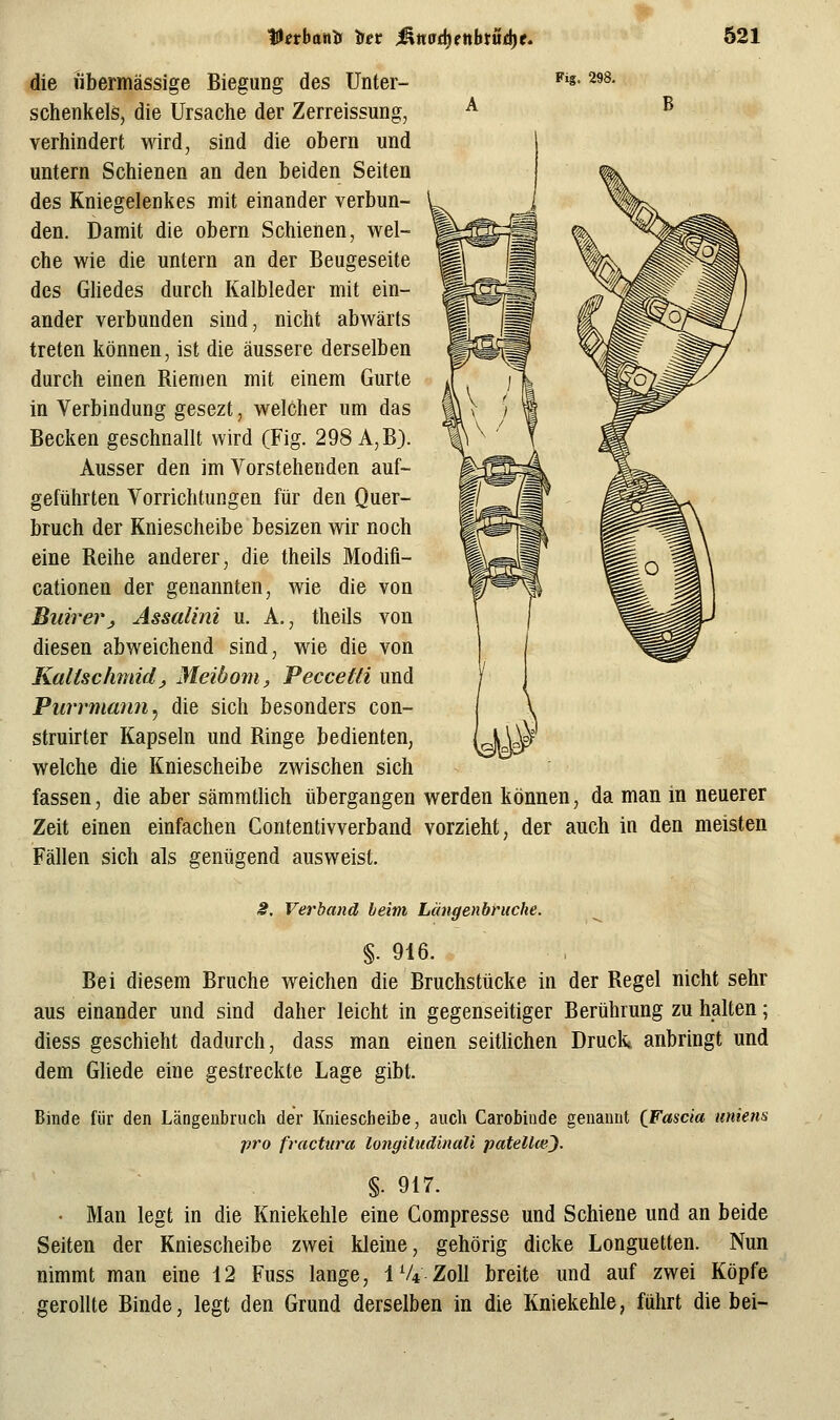 die übermässige Biegung des Unter- ^'s- ^»s. schenkeis, die Ursache der Zerreissung, ^ verhindert wird, sind die obern und untern Schienen an den beiden Seiten des Kniegelenkes mit einander verbun- den. Damit die obern Schienen, wel- che wie die untern an der Beugeseite des Gliedes durch Kalbleder mit ein- ander verbunden sind, nicht abwärts treten können, ist die äussere derselben durch einen Riemen mit einem Gurte in Verbindung gesezt, welcher um das Becken geschnallt wird (Fig. 298 A,B). Ausser den im Vorstehenden auf- geführten Vorrichtungen für den Quer- bruch der Kniescheibe besizen wir noch eine Reihe anderer, die theils Modifi- cationen der genannten, wie die von Buirerj Assalini u. A., theils von diesen abweichend sind, wie die von Kaitsclimid^ Meibom, Peccetli und Purrmann^ die sich besonders con- struirter Kapseln und Ringe bedienten, welche die Kniescheibe zwischen sich fassen, die aber sämmthch übergangen werden können, da man in neuerer Zeit einen einfachen Contentivverband vorzieht, der auch in den meisten Fällen sich als genügend ausweist. 2, Verband beim Längenbruche. §. 916. Bei diesem Bruche weichen die Bruchstücke in der Regel nicht sehr aus einander und sind daher leicht in gegenseitiger Berührung zu halten; diess geschieht dadurch, dass man einen seitlichen Druck anbringt und dem Gliede eine gestreckte Lage gibt. Binde für den Längeubriich der Kniescheibe, auch Carobiude genannt (Fascia uniens pro fractiira longitudinali patellce'). §. 9f7. • Man legt in die Kniekehle eine Compresse und Schiene und an beide Seiten der Kniescheibe zwei kleine, gehörig dicke Longuetten. Nun nimmt man eine 12 Fuss lange, IV4.Z0II breite und auf zwei Köpfe gerollte Binde, legt den Grund derselben in die Kniekehle, fuhrt die bei-