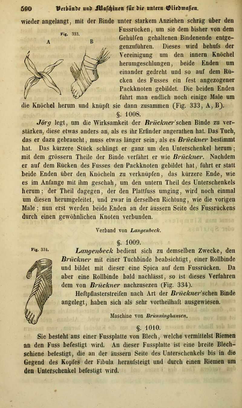 Fig. 333. Wieder angelangt, mit der Binde unter starkem Anziehen schräg über den Fussrücken, um sie dem bisher von dem Gehülfen gehaltenen Bindenende entge- genzuführen. Dieses wird behufs der Vereinigung um den Innern Knöchel herumgeschlungen, beide Enden um einander gedreht und so auf dem Rü- cken des Fusses ein fest angezogener Packknoten gebildet. Die beiden Enden führt man endlich noch einige Male um die Knöchel herum und knüpft sie dann zusammen (Fig. 333, A, B). §. 1008. Jörg legt, um die Wirksamkeit der Ri'ück7ier'scheu Binde zu ver- stärken, diese etwas anders an, als es ihr Erfinder angerathen hat. Das Tuch, das er dazu gebraucht, muss etwas länger sein, als es Brückner bestimmt hat. Das kürzere Stück schlingt er ganz um den Unterschenkel herum; mit dem grössern Theile der Binde verfährt er wie Brückner. Nachdem er auf dem Rücken des Fusses den Packknoten gebildet hat, führt er statt beide Enden über den Knöcheln zu verknüpfen, das kürzere Ende, wie es im Anfange mit ihm geschah, um den untern Theil des Unterschenkels herum; der Theil dagegen, der den Plattfuss umging, wird noch einmal um diesen herumgeleilet, und zwar in derselben Richtung, wie die vorigen Male ; nun erst werden beide Enden an der äussern Seite des Fussrückens durch einen gewöhnlichen Knoten verbunden. Verband von Langenbeck. Fig. 33 i. §. 1009. Langenbeck bedient sich zu demselben Zwecke, den Brückner mit einer Tuchbinde beabsichtigt, einer Rollbinde und bildet mit dieser eine Spica auf dem Fussrücken. Da aber eine Rollbinde bald nachlässt, so ist dieses Verfahren dem von Brückner nachzusezen (Fig. 334). Heftpflasterstreifen nach Art der Brückner'sohtn Binde angelegt, haben sich als sehr vortheilhaft ausgewiesen. Maschine von Brünninghausen. §.1010. Sie besteht aus einer Fussplatte von Blech, welche vermittelst Riemen an den Fuss befestigt wird. An dieser Fussplatte ist eine breite Blech- schiene befestigt, die an der äussern Seite des Unterschenkels bis in die Gegend des Kopfes der Fibula heraufsteigt und durch einen Riemen um den Unterschenkel befestigt wird.