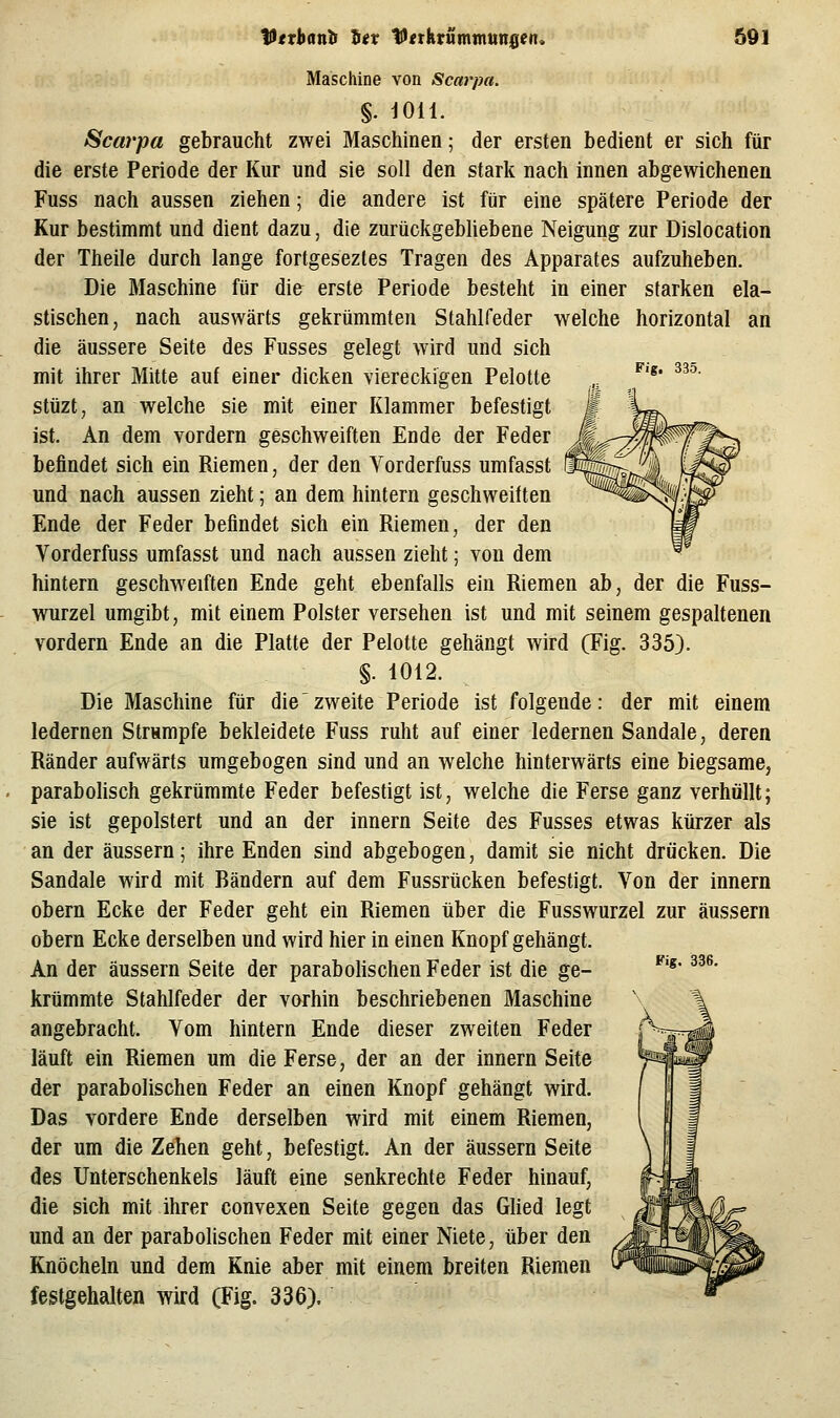 Fig. 335. Maschine von Scarpa. §. 1011. Scai'pa gebraucht zwei Maschinen; der ersten bedient er sich für die erste Periode der Kur und sie soll den stark nach innen abgewichenen Fuss nach aussen ziehen; die andere ist für eine spätere Periode der Kur bestimmt und dient dazu, die zurückgebliebene Neigung zur Dislocation der Theile durch lange fortgeseztes Tragen des Apparates aufzuheben. Die Maschine für die erste Periode besteht in einer starken ela- stischen, nach auswärts gekrümmten Stahlfeder welche horizontal an die äussere Seite des Fusses gelegt wird und sich mit ihrer Mitte auf einer dicken viereckigen Pelotte stüzt, an welche sie mit einer Klammer befestigt ist. An dem vordem geschweiften Ende der Feder befindet sich ein Riemen, der den Vorderfuss umfasst und nach aussen zieht; an dem hintern geschweilten Ende der Feder befindet sich ein Riemen, der den Vorderfuss umfasst und nach aussen zieht; von dem hintern geschweiften Ende geht ebenfalls ein Riemen ab, der die Fuss- wurzel umgibt, mit einem Polster versehen ist und mit seinem gespaltenen vordem Ende an die Platte der Pelotte gehängt wird (Fig. 335). §. 1012. Die Maschine für die'zweite Periode ist folgende: der mit einem ledernen Strumpfe bekleidete Fuss ruht auf einer ledernen Sandale, deren Ränder aufwärts umgebogen sind und an welche hinterwärts eine biegsame, parabolisch gekrümmte Feder befestigt ist, welche die Ferse ganz verhüllt; sie ist gepolstert und an der Innern Seite des Fusses etwas kürzer als an der äussern; ihre Enden sind abgebogen, damit sie nicht drücken. Die Sandale wird mit Bändern auf dem Fussrücken befestigt. Von der Innern obern Ecke der Feder geht ein Riemen über die Fusswurzel zur äussern obem Ecke derselben und wird hier in einen Knopf gehängt. An der äussern Seite der parabolischen Feder ist die ge- krümmte Stahlfeder der vorhin beschriebenen Maschine angebracht. Vom hintern Ende dieser zweiten Feder läuft ein Riemen um die Ferse, der an der innern Seite der parabolischen Feder an einen Knopf gehängt wird. Das vordere Ende derselben wird mit einem Riemen, der um die Zehen geht, befestigt. An der äussern Seite des Unterschenkels läuft eine senkrechte Feder hinauf, die sich mit ihrer convexen Seite gegen das Glied legt und an der parabolischen Feder mit einer Niete, über den Knöcheln und dem Knie aber mit einem breiten Riemen festgehalten wird (Fig. 336). Fig. 336.