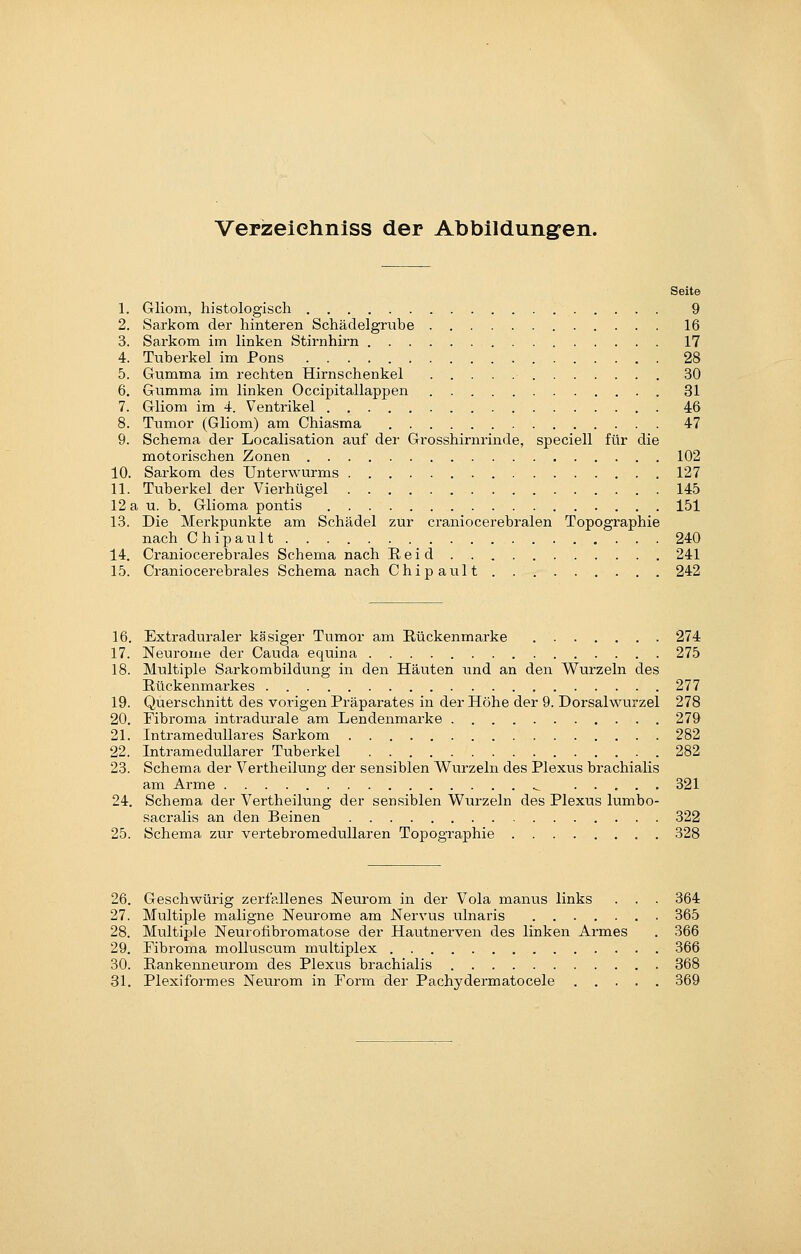 Verzelehniss der Abbildung-en. Seite 1. Gliom, histologisch 9 2. Sarkom der hinteren Schädelgriibe 16 3. Sarkom im linken Stirnhirn 17 4. Tuberkel im Pons 28 5. Gumma im rechten Hirnschenkel 30 6. Gumma im linken Occipitallappen 31 7. Gliom im 4. Ventrikel 46 8. Tumor (Gliom) am Chiasma 47 9. Schema der Localisation auf der Grosshirnrinde, speciell für die motorischen Zonen 102 10. Sarkom des Unterwurms 127 11. Tuberkel der Vierhügel 145 12 a u. b. Glioma pontis 151 13. Die Merkpunkte am Schädel zur craniocerebralen Topographie nach Chipault 240 14. Craniocerebrales Schema nach Eeid 241 15. Craniocerebrales Schema nach Chipault . . 242 16. Extraduraler käsiger Tumor am Eückenmarke 274 17. Neurome der Cauda equina 275 18. Multiple Sarkombildung in den Häuten und an den Wurzeln des Rückenmarkes 277 19. Querschnitt des vorigen Präparates in der Höhe der 9. Dorsalwurzel 278 20. Fibroma intradurale am Lendenmarke 279 21. Intramedullares Sarkom 282 22. Intramedullarer Tuberkel 282 23. Schema der Vertheilung der sensiblen Wurzeln des Plexus brachialis am Arme .^ 321 24. Schema der Vertheilung der sensiblen Wurzeln des Plexus lumbo- sacralis an den Beinen 322 25. Schema zur vertebromeduUaren Topographie 328 26. Geschwürig zerfallenes Neurom in der Vola manus links . . . 364 27. Multiple maligne Neurome am Nervus ulnaris 365 28. Multiple Neurofibromatose der Hautnerven des linken Armes . 366 29. Fibroma molluscum multiplex 366 30. Bankenneurom des Plexus brachialis 368 31. Plexiformes Neurom in Form der Pachydermatocele 369