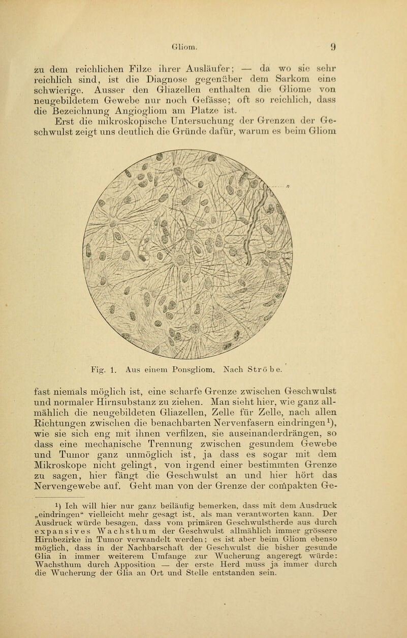 zu dem reichlichen Filze ihrer Ausläufer; — da wo sie sehr reichlich sind, ist die Diagnose gegenüber dem Sarkom eine schwierige. Ausser den Grliazellen entlialten die Gliome von neugebildetem Gewebe nur nocli Gefässe; oft so reichlich, dass die Bezeichnung Angiogiiom am Platze ist. Erst die mikroskopische Untersuchung der Grenzen der Ge- schwulst zeigt uns deutlich die Gründe dafür, warum es beim Gliom Fia;. 1. Aus einem Ponseiiom. Nach Ströbe. fast niemals möglich ist, eine scharfe Grenze zwischen Geschwulst und normaler Hirnsubstanz zu ziehen. Man sieht hier, wie ganz all- mählich die neugebildeten Gliazellen, Zelle für Zelle, nach allen Richtungen zwischen die benachbarten Nervenfasern eindringen^), wie sie sich eng mit ihnen verfilzen, sie auseinanderdrängen, so dass eine mechanische Trennung zwischen gesundem Gewebe und Tumor ganz unmöglich ist, ja dass es sogar mit dem Mikroskope nicht gelingt, von irgend einer bestimmten Grenze zu sagen, hier fängt die Geschwulst an und hier hört das Nervengewebe auf. Geht man von der Grenze der coinpakten Ge- 1) Ich will hier nur ganz beiläufig bemerken, dass mit dem Ausdi'uck „eindringen vielleicht mehr gesagt ist, als man verantworten kann. Der Ausdruck würde besagen, dass vom primären Geschwulstherde aus durch expansives Wachsthum der Geschwulst allmählich immer grössere Hirnbezirke in Tumor verwandelt werden; es ist aber beim Gliom ebenso möglich, dass in der Nachbarschaft der Geschwulst die bisher gesnude Glia in immer weiterem Umfange zur Wucheriuig angeregt wiü-de: Wachsthum durch Apposition — der erste Herd muss ja immer durch die Wucheruna; der Glia an Ort und Stelle entstanden sein.