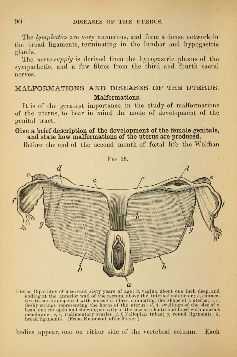 The lymphatics are very numerous, and form a dense network in the broad ligaments, terminating in the lumbar and hypogastric glands. The nerve-supply is derived from the hypogastric plexus of the sympathetic, and a few fibres from the third and fourth sacral nerves. MALFORMATIONS AND DISEASES OF THE UTERUS. Malformations. It is of the greatest importance, in the study of malformations of the uterus, to bear in mind the mode of development of the genital tract. Give a brief description of the development of the female genitals, and state how malformations of the uterus are produced. Before the end of the second month of foetal life the Wolffian Fig 36. uterus Bipartitus of a servant sixty years of age: «, vagina, about one inch deep, and ending at the anterior wall of the rectum, above the internal sphincter; b, connec- tive tissue interspersed with muscular fibres, simulating the shape of a uterus; c. c, fleshy strings representing the horns of the uterus ; (/, (/, swellings of the size of a bean, one cui open and showing a cavity of tlie size of a lentil and lined with mucous membrane; e,e, rudimentary ovaries;/,/, Falloi)iau tubes; g, round ligaments; h, broad ligaments. (From Kussmaul, after Mayer.) bodies appear, one on either side of the vertebral column. Kach