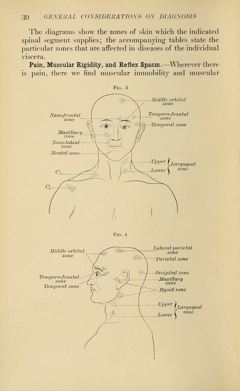 The diagrams show the zones of skin which the indicated spinal segment suppHes; the accompanying tables state the particular zones that are affected in diseases of the individual viscera. Pain, Muscular Rigidity, and Reflex Spasm.—Wherever there is pain, there we find muscular immobility and muscular Fig. 3 Naso-frontal zone MaxiUar zone Naso-labial zone Middle orbital zone Temporo-fvontal zone Fig. 4 Middle orbital zone Temporo-frontal zone Temporal zone Lcderal parietal zone Parietal zone Occipital zone Mamillary zone Hyoid zone Upper ) r Laryngeal r r zone Lower \