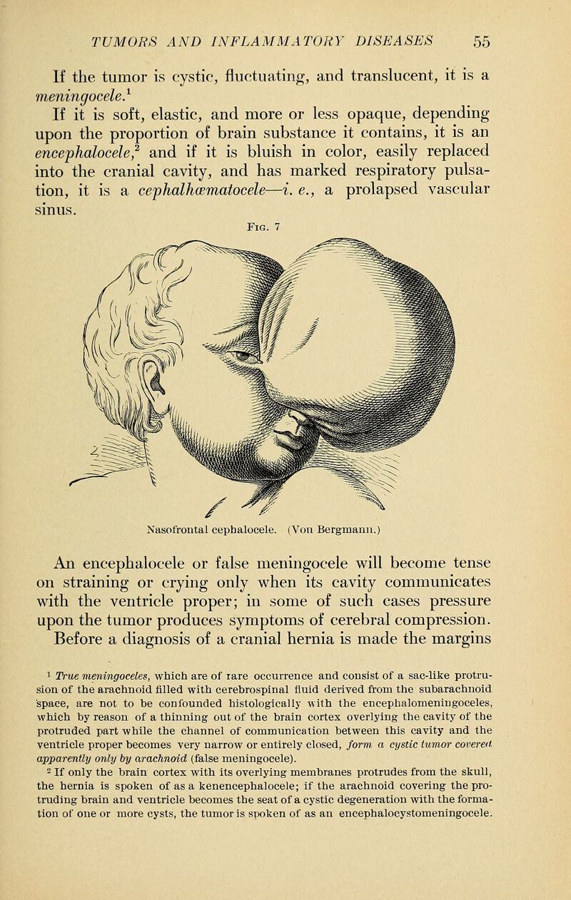 If the tumor is cystic, fluctuating, and translucent, it is a meningocele} If it is soft, elastic, and more or less opaque, depending upon the proportion of brain substance it contains, it is an encephalocele,^ and if it is bluish in color, easily replaced into the cranial cavity, and has marked respiratory pulsa- tion, it is a cephalhcBmatocele—i. e., a prolapsed vascular sinus. Fig. Nasofrontal cephalocele. (Von Bergmaun.) An encephalocele or false meningocele will become tense on straining or crying only when its cavity communicates with the ventricle proper; in some of such cases pressure upon the tumor produces symptoms of cerebral compression. Before a diagnosis of a cranial hernia is made the margins 1 True meningoceles, which are of rare occurrence and consist of a sac-like protru- sion of the arachnoid filled with cerebrospinal fluid derived from the subarachnoid space, are not to be confounded histologically with the encephalomeningoceles, which by reason of a thinning out of the brain cortex overlying the cavity of the protruded part while the channel of communication between this cavity and the ventricle proper becomes very narrow or entirely closed, form a cystic tumor covered, apparently only by arachnoid (false meningocele). - If only the brain cortex with its overlying membranes protrudes from the skull, the hernia is spoken of as a kenencephalocele; if the arachnoid covering the pro- truding brain and ventricle becomes the seat of a cystic degeneration with the forma- tion of one or more cysts, the tumor is spoken of as an encephalocystomeningocele.