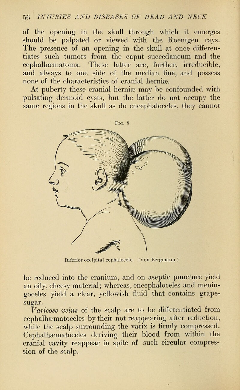of the opening in the skull through which it emerges should be palpated or viewed with the Roentgen rays. The presence of an opening in the skull at once differen- tiates such tumors from the caput succedaneum and the cephalhsematoma. These latter are, further, irreducible, and always to one side of the median line, and possess none of the characteristics of cranial hernise. At puberty these cranial hernise may be confounded with pulsating dermoid cysts, but the latter do not occupy the same regions in the skull as do encephaloceles, they cannot Fig. 8 Inferior occipital cephalocele. (Von Bergmann.) be reduced into the cranium, and on aseptic puncture yield an oily, cheesy material; whereas, encephaloceles and menin- goceles yield a clear, yellowish fluid that contains grape- sugar. Varicose veins of the scalp are to be differentiated from cephalhsematoceles by their not reappearing after reduction, while the scalp surrounding the varix is firmly compressed. Cephalhsematoceles deriving their blood from within the cranial cavity reappear in spite of such circular compres- sion of the scalp.