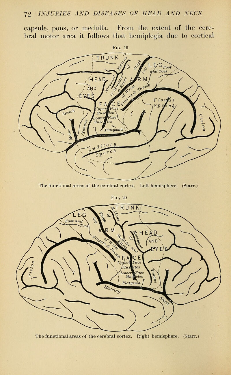 capsule, pons, or medulla. From the extent of the cere- bral motor area it follows that hemiplegia due to cortical Fig. 19 The functional areas of the cerebral cortex. Left hemisphere. (Starr.) Fig. 20 The functional areas of the cerebral cortex. Right hemisphere. (Starr.)