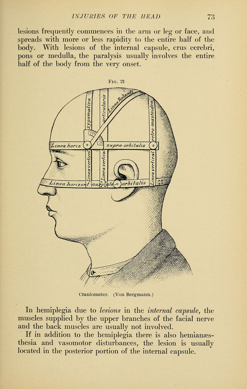lesions frequently commences in the arm or leg or face, and spreads with more or less rapidity to the entire half of the body. With lesions of the internal capsule, crus cerebri, pons or medulla, the paralysis usually involves the entire half of the body from the very onset. Fig. 21 Craniometer. (Von Bergmann.) In hemiplegia due to lesions in the internal capsule, the muscles supplied by the upper branches of the facial nerve and the back muscles are usually not involved. If in addition to the hemiplegia there is also hemianses- thesia and vasomotor disturbances, the lesion is usually located in the posterior portion of the internal capsule.