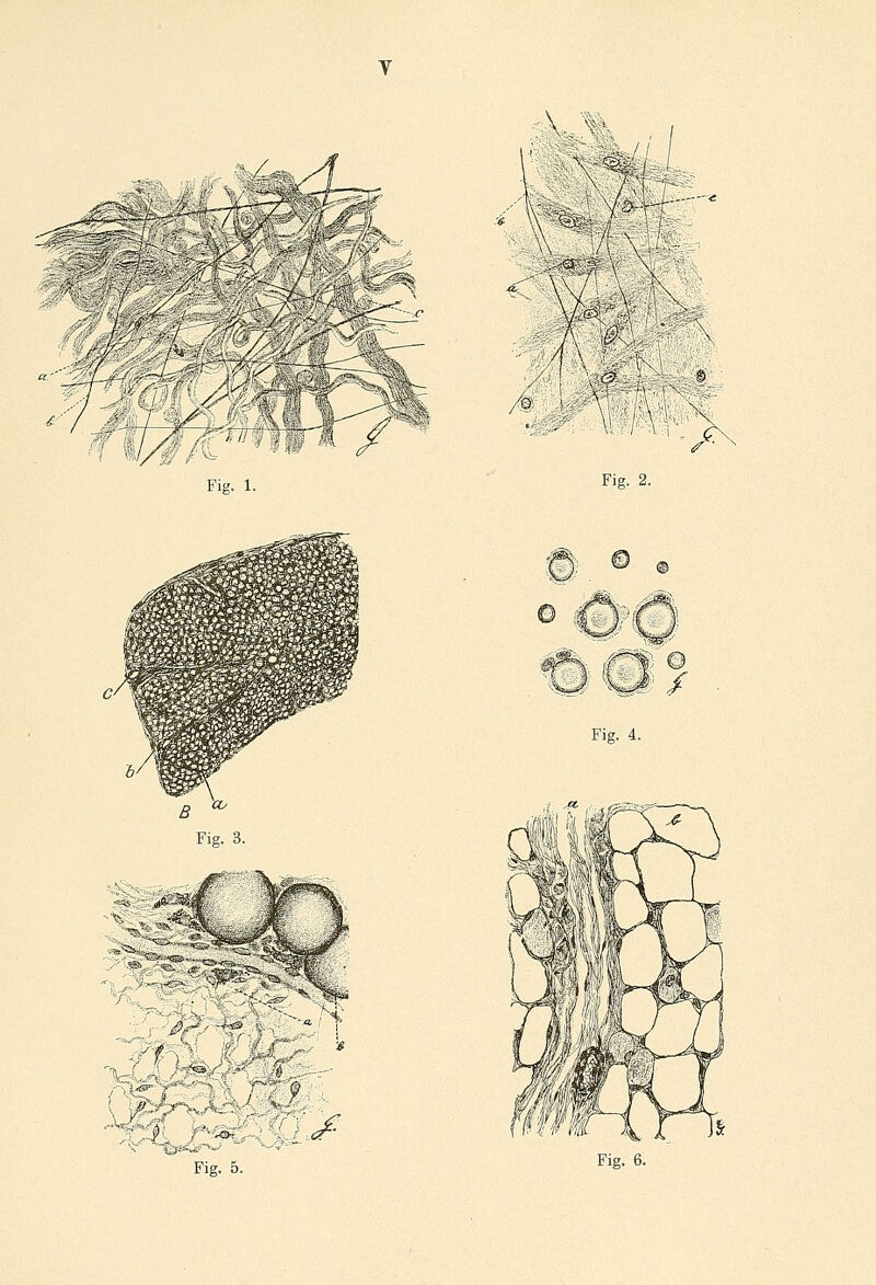 Fig. 1. V1 Fig. 2. Fig. 3. ö / Fig. 4.