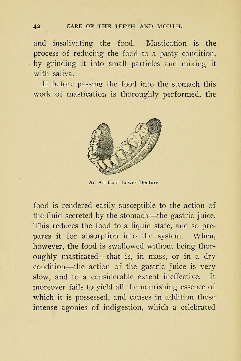 and insalivating the food. Mastication is the process of reducing the food to a pasty condition, by grinding it into small particles and mixing it with saliva. If before passing the food into the stomach this work of mastication is thoroughly performed, the An Artificial Lower Denture. food is rendered easily susceptible to the action of the fluid secreted by the stomach—the gastric juice. This reduces the food to a liquid state, and so pre- pares it for absorption into the system. When, however, the food is swallowed without being thor- oughly masticated—that is, in mass, or in a dry condition—the action of the gastric juice is very slow, and to a considerable extent ineffective. It moreover fails to yield all the nourishing essence of which it is possessed, and causes in addition those intense agonies of indigestion, which a celebrated