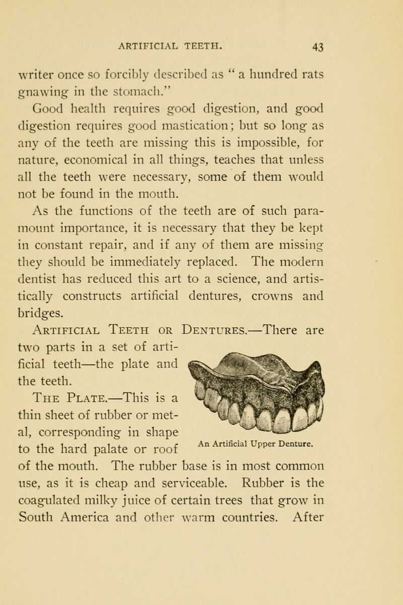 writer once so forcibly described as  a hundred rats gnawing in the stoniacli. Good health requires good digestion, and good tligestion requires good mastication; but so long as any of the teeth are missing this is impossible, for nature, economical in all things, teaches that unless all the teeth were necessary, some of them would not be found in the mouth. As the functions of the teeth are of such para- mount importance, it is necessary that they be kept in constant repair, and if any of them are missing they should be immediately replaced. The modern dentist has reduced this art to a science, and artis- tically constructs artificial dentures, crowns and bridges. Artificial Teeth or Dentures.—There are two parts in a set of arti- ficial teeth—the plate and the teeth. The Plate.—This is a thin sheet of rubber or met- al, corresponding in shape , , 1 1 J 1 , r An Artificial Upper Denture. to the hard palate or roof of the mouth. The rubber base is in most common use, as it is cheap and serviceable. Rubber is the coagulated milky juice of certain trees that grow in South America and other warm countries. After