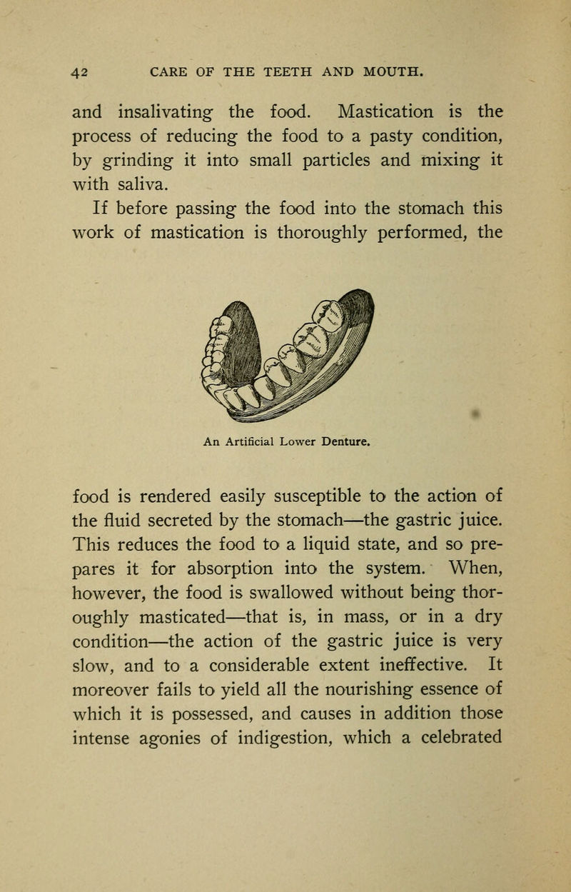 and insalivating the food. Mastication is the process of reducing the food to a pasty condition, by grinding it into small particles and mixing it with saliva. If before passing the food into the stomach this work of mastication is thoroughly performed, the An Artificial Lower Denture. food is rendered easily susceptible to the action of the fluid secreted by the stomach—the gastric juice. This reduces the food to a liquid state, and so pre- pares it for absorption into the system. When, however, the food is swallowed without being thor- oughly masticated—that is, in mass, or in a dry condition—the action of the gastric juice is very slow, and to a considerable extent ineffective. It moreover fails to yield all the nourishing essence of which it is possessed, and causes in addition those intense agonies of indigestion, which a celebrated