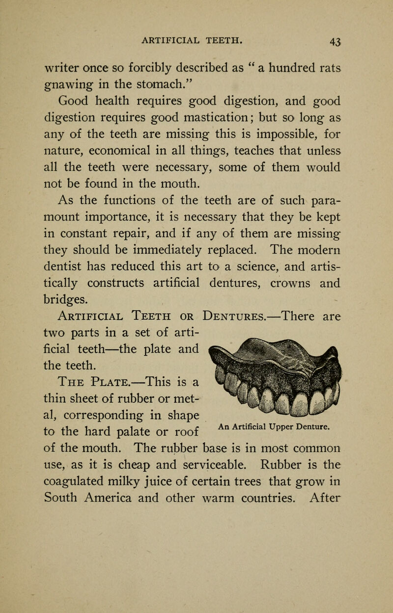 writer once so forcibly described as  a hundred rats gnawing in the stomach. Good health requires good digestion, and good digestion requires good mastication; but so long as any of the teeth are missing this is impossible, for nature, economical in all things, teaches that unless all the teeth were necessary, some of them would not be found in the mouth. As the functions of the teeth are of such para- mount importance, it is necessary that they be kept in constant repair, and if any of them are missing they should be immediately replaced. The modern dentist has reduced this art to a science, and artis- tically constructs artificial dentures, crowns and bridges. Artificial Teeth or Dentures.—There are two parts in a set of arti- ficial teeth—the plate and the teeth. The Plate.—This is a thin sheet of rubber or met- al, corresponding in shape +~ 4-U~ U~~A ~„1«.*.~ ~~ r An Artificial Upper Denture. to the hard palate or roof of the mouth. The rubber base is in most common use, as it is cheap and serviceable. Rubber is the coagulated milky juice of certain trees that grow in South America and other warm countries. After