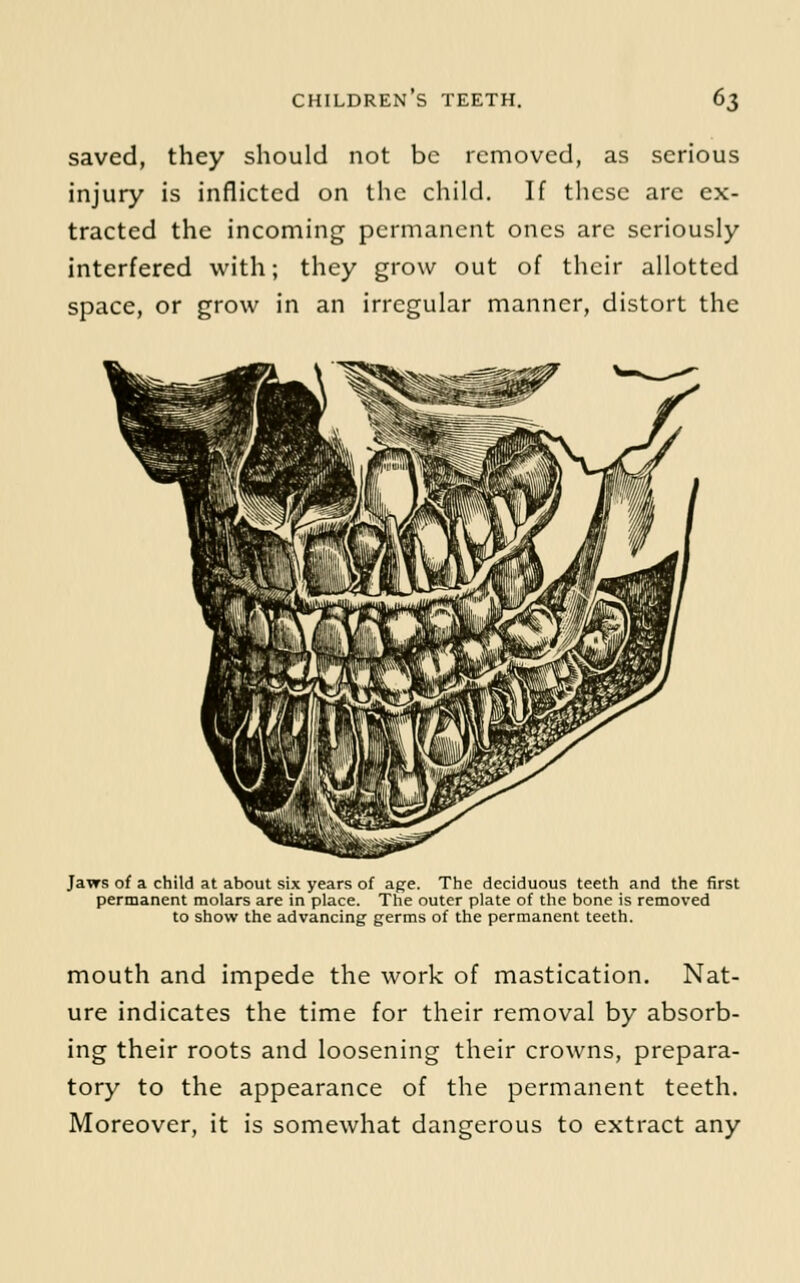 saved, they should not be removed, as serious injury is inflicted on the child. If these are ex- tracted the incoming permanent ones are seriously interfered with; they grow out of their allotted space, or grow in an irregular manner, distort the Jaws of a child at about six years of age. The deciduous teeth and the first permanent molars are in place. The outer plate of the bone is removed to show the advancing germs of the permanent teeth. mouth and impede the work of mastication. Nat- ure indicates the time for their removal by absorb- ing their roots and loosening their crowns, prepara- tory to the appearance of the permanent teeth. Moreover, it is somewhat dangerous to extract any