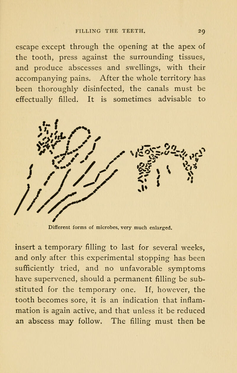 escape except through the opening at the apex of the tooth, press against the surrounding tissues, and produce abscesses and swellings, with their accompanying pains. After the whole territory has been thoroughly disinfected, the canals must be effectually filled. It is sometimes advisable to / Different forms of microbes, very much enlarged. insert a temporary filling to last for several weeks, and only after this experimental stopping has been sufficiently tried, and no unfavorable symptoms have supervened, should a permanent filling be sub- stituted for the temporary one. If, however, the tooth becomes sore, it is an indication that inflam- mation is again active, and that unless it be reduced an abscess may follow. The filling must then be