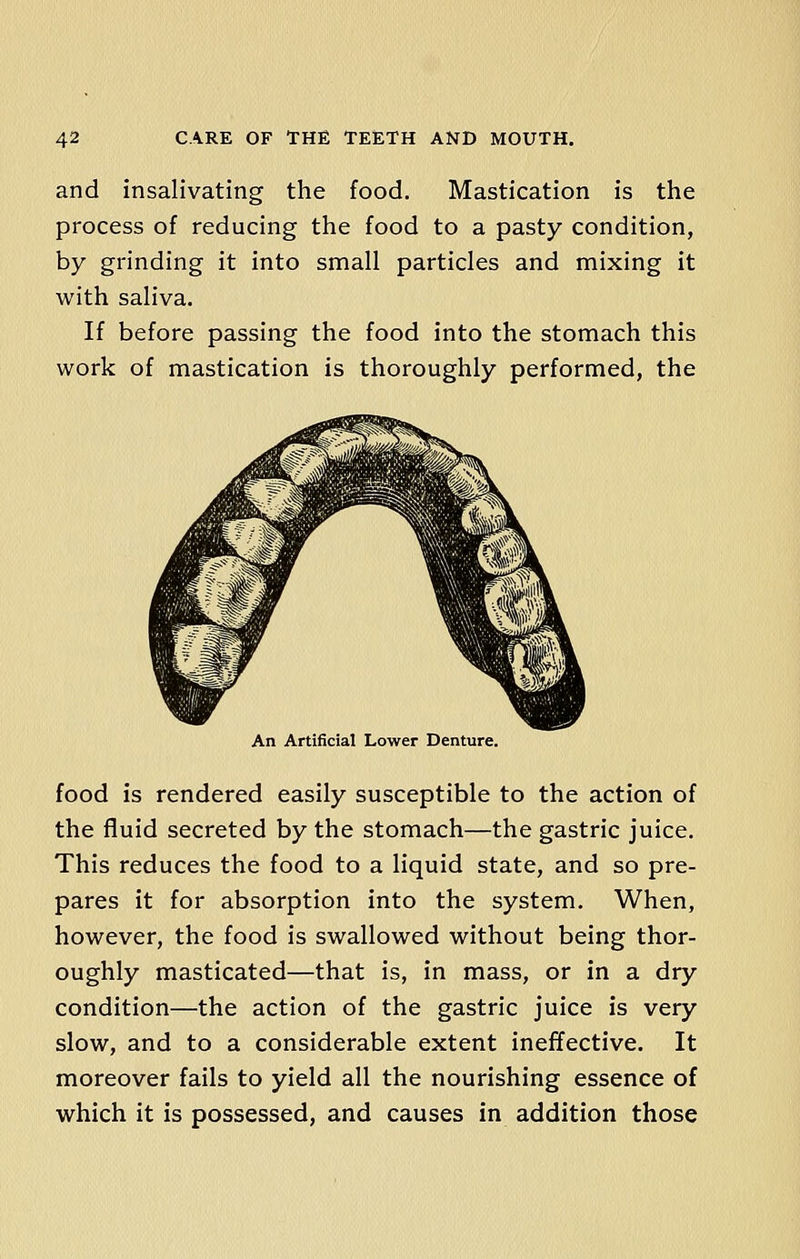 and insalivating the food. Mastication is the process of reducing the food to a pasty condition, by grinding it into small particles and mixing it with saliva. If before passing the food into the stomach this work of mastication is thoroughly performed, the An Artificial Lower Denture. food is rendered easily susceptible to the action of the fluid secreted by the stomach—the gastric juice. This reduces the food to a liquid state, and so pre- pares it for absorption into the system. When, however, the food is swallowed without being thor- oughly masticated—that is, in mass, or in a dry condition—the action of the gastric juice is very slow, and to a considerable extent ineffective. It moreover fails to yield all the nourishing essence of which it is possessed, and causes in addition those