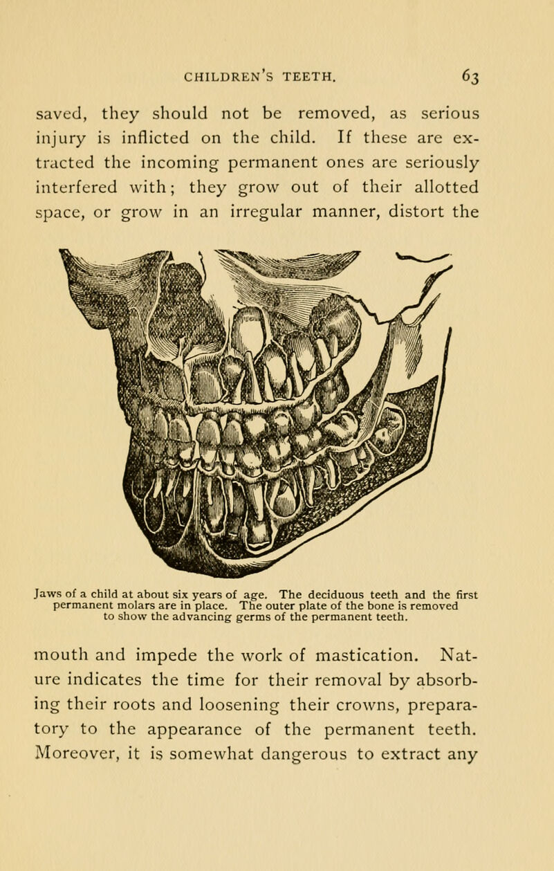 saved, they should not be removed, as serious injury is inflicted on the child. If these are ex- tracted the incoming permanent ones are seriously interfered with; they grow out of their allotted space, or grow in an irregular manner, distort the Jaws of a child at about six years of age. The deciduous teeth and the first permanent molars are in place. The outer plate of the bone is removed to show the advancing germs of the permanent teeth. mouth and impede the work of mastication. Nat- ure indicates the time for their removal by absorb- ing their roots and loosening their crowns, prepara- tory to the appearance of the permanent teeth. Moreover, it is somewhat dangerous to extract any