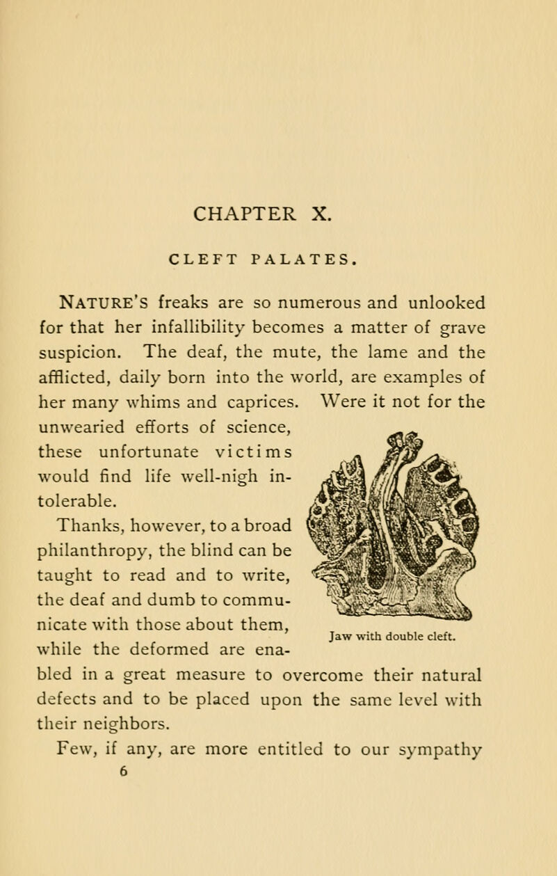 CHAPTER X. CLEFT PALATES. NATURE'S freaks are so numerous and unlooked for that her infallibility becomes a matter of grave suspicion. The deaf, the mute, the lame and the afflicted, daily born into the world, are examples of her many whims and caprices. Were it not for the unwearied efforts of science, these unfortunate victims would find life well-nigh in- tolerable. Thanks, however, to a broad philanthropy, the blind can be taught to read and to write, the deaf and dumb to commu- nicate with those about them, while the deformed are ena- bled in a great measure to overcome their natural defects and to be placed upon the same level with their neighbors. Few, if any, are more entitled to our sympathy Jaw with double cleft.