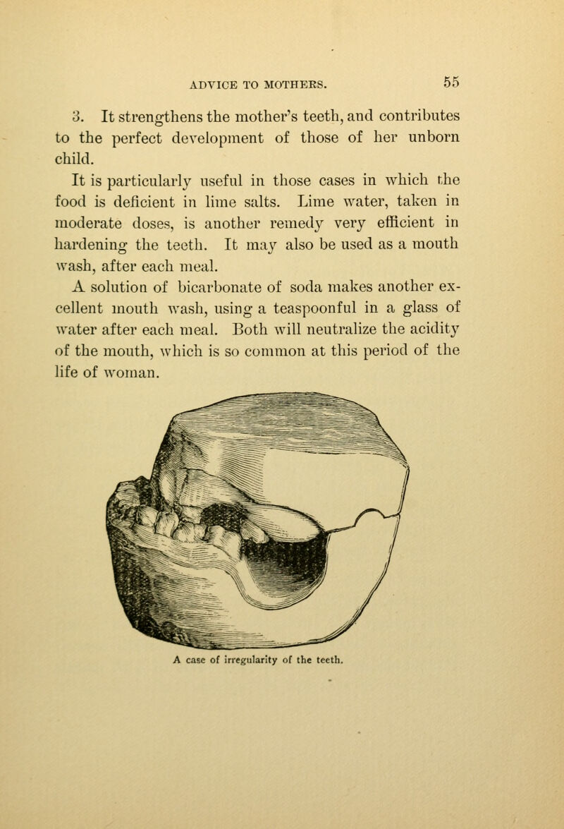 3. It strengthens the mother's teeth, and contributes to the perfect development of those of her unborn child. It is particularly useful in those cases in which the food is deficient in lime salts. Lime water, taken in moderate doses, is another remedy very efficient in hardening the teeth. It may also be used as a mouth wash, after each meal. A solution of bicarbonate of soda makes another ex- cellent mouth wash, using a teaspoonfid in a glass of water after each meal. Both will neutralize the acidity of the mouth, which is so common at this period of the life of woman. A case of irregularity of the teeth.