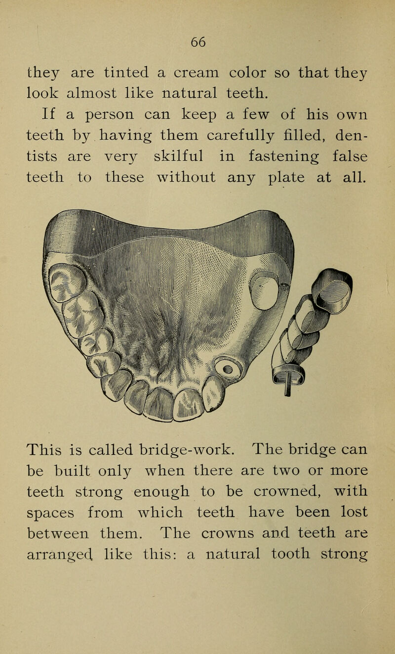 they are tinted a cream color so that they look almost like natural teeth. If a person can keep a few of his own teeth by having them carefully filled, den- tists are very skilful in fastening false teeth to these without any plate at all. This is called bridge-work. The bridge can be built only when there are two or more teeth strong enough to be crowned, with spaces from which teeth have been lost between them. The crowns and teeth are arranged like this: a natural tooth strong