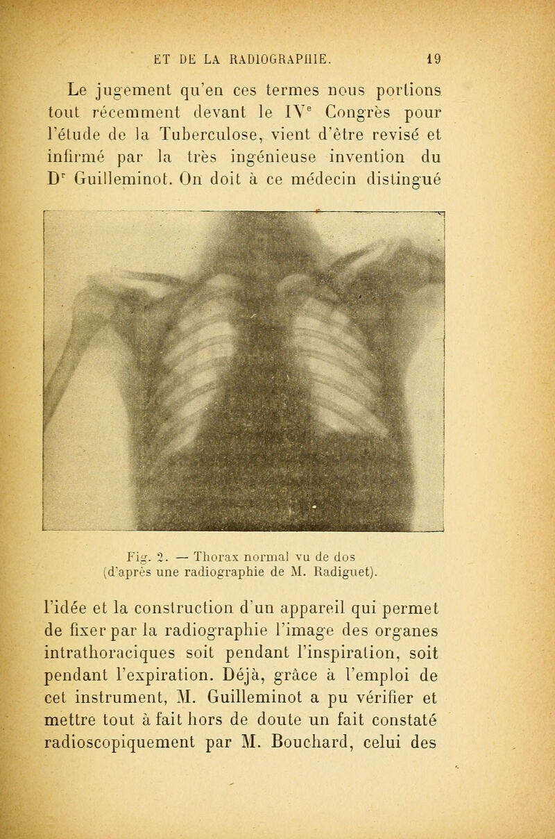 Le jugement qu'en ces termes nous portions tout récemment devant le lY^ Congrès pour l'étude de la Tuberculose, vient d'être revisé et infirmé par la très ingénieuse invention du D'' Guilleminot. On doit à ce médecin distingué Fig. 2. — Thorax normal vu de dos (d'après une radiographie de M. Radiguet). l'idée et la construction d'un appareil qui permet de fixer par la radiographie l'image des organes intratlioraciques soit pendant l'inspiration, soit pendant l'expiration. Déjà, grâce à l'emploi de cet instrument, M. Guilleminot a pu vérifier et mettre tout à fait hors de doute un fait constaté radioscopiquement par M. Bouchard, celui des