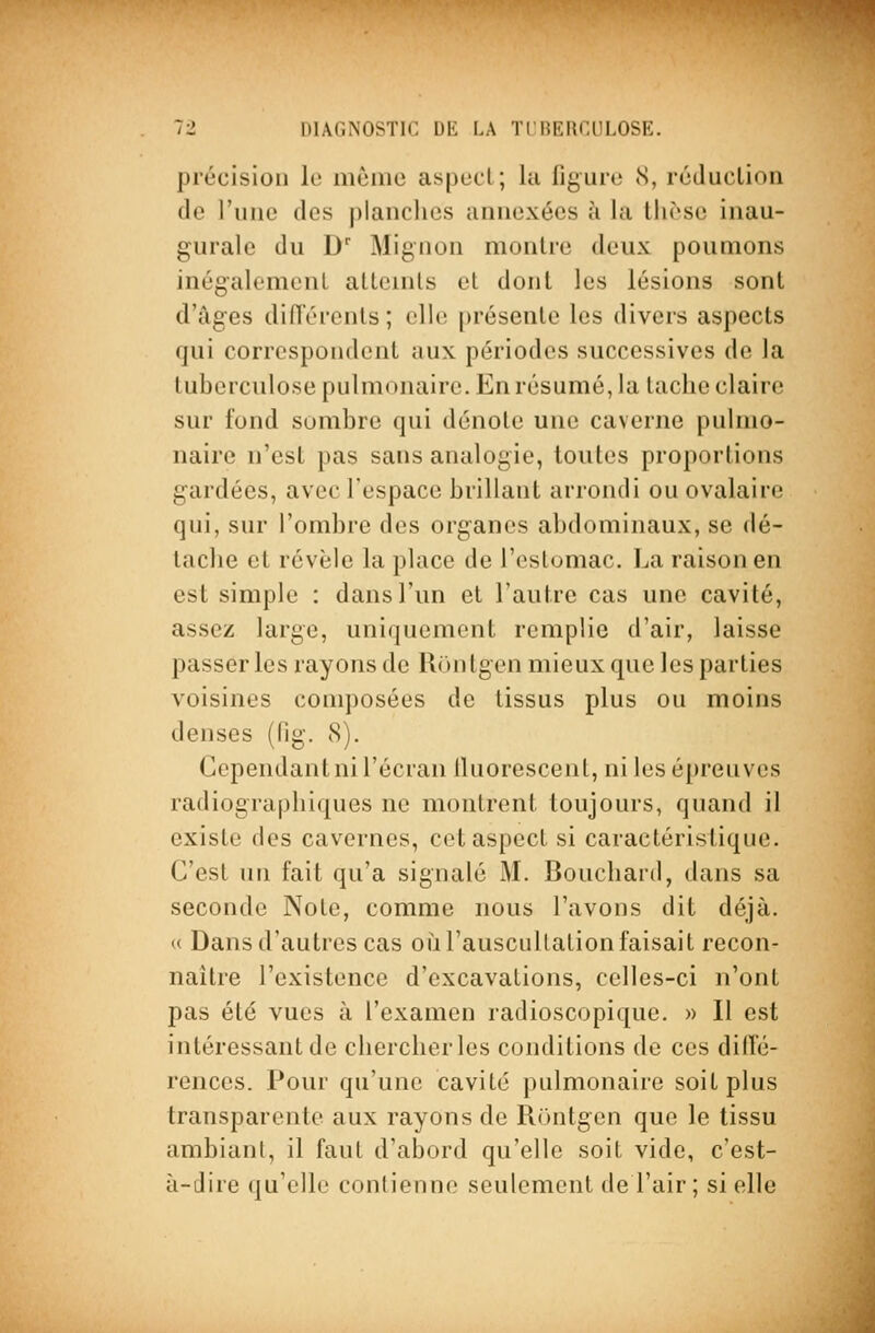 précision le môme as(3ucl; lu figure S, ruduclion de ruiic des planches annexées à la tlicsc inau- gurale du D' Mignon montre deux poumons inégalomenl atlemls et dont les lésions sont d'âges difTérenls ; clK; [)résente les divers aspects qui correspondent aux périodes successives do la tuberculose pulmonaire. En résumé, la tache claire sur fond sombre qui dénote une caverne pulmo- naire n'est pas sans analogie, toutes proportions gardées, avec l'espace brillant arrondi ou ovalaire qui, sur l'ombre des organes abdominaux, se dé- tache et révèle la place de l'estomac. La raison en est simple : dans l'un et l'autre cas une cavité, assez large, uniquement remplie d'air, laisse passer les rayons de Rontgen mieux que les parties voisines composées de tissus plus ou moins denses (fig. 8). Cependant ni l'écran lluorescent, ni les épreuves radiographiques ne montrent toujours, quand il existe des cavernes, cet aspect si caractéristique. C'est un fait qu'a signalé M. Bouchard, dans sa seconde Note, comme nous l'avons dit déjà. (( Dans d'autres cas où l'auscultation faisait recon- naître l'existence d'excavations, celles-ci n'ont pas été vues à l'examen radioscopique. » Il est intéressant de chercher les conditions de ces difïe- renccs. Pour qu'une cavité pulmonaire soit plus transparente aux rayons de Rontgen que le tissu ambiant, il faut d'abord qu'elle soit vide, c'est- à-dire qu'elle conlienne seulement de l'air ; si elle