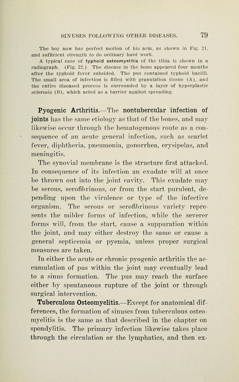 The boy now has perfect motion of his arm, as shown in Fig. 21, and sufficient strength to do ordinary hard work. A typical case of typhoid osteomyelitis of the tibia is shown in a radiograph. (Fig. 22.) The disease in the bone appeared four months after the typhoid fever subsided. The pus contained typhoid bacilli. The small area of infection is filled with granulation tissue (A), and the entire diseased process is surrounded by a layer of hyperplastic sclerosis (B), which acted as a barrier against spreading. Pyogenic Arthritis.—The nontubercular infection of joints has the same etiology as that of the bones, and may likewise occur through the hematogenous route as a con- sequence of an acute general infection, such as scarlet fever, diphtheria, pneumonia, gonorrhea, erysipelas, and meningitis. The synovial membrane is the structure first attacked. In consequence of its infection an exudate will at once be thrown out into the joint cavity. This exudate may be serous, serofibrinous, or from the start purulent, de- pending upon the virulence or type of the infective organism. The serous or serofibrinous variety repre- sents the milder forms of infection, while the severer forms will, from the start, cause a suppuration within the joint, and may either destroy the same or cause a general septicemia or pyemia, unless proper surgical measures are taken. In either the acute or chronic pyogenic arthritis the ac- cumulation of pus within the joint may eventually lead to a sinus formation. The pus may reach the surface either by spontaneous rupture of the joint or through surgical intervention. Tuberculous Osteomyelitis.—Except for anatomical dif- ferences, the formation of sinuses from tuberculous osteo- myelitis is the same as that described in the chapter on spondylitis. The primary infection likewise takes place through the circulation or the lymphatics, and then ex-