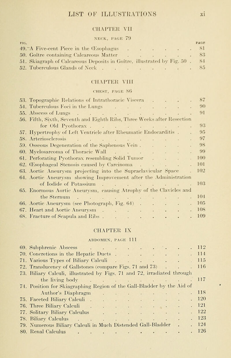 CHAPTER VII NECK, PAGE 79 FIG. 49.~A Five-cent Piece in the (Esophagus 50. Goitre containing ('ideaicons Matter 51. Skiagraph of Calcareous Deposits in Goitre, 52. Tuberculous Glands of Neck -1 rated by Fit PAGE 81 83 si 85 CHAPTER VIII CHEST, PAGE 86 53. Topographic Relations <>f Intrathoracic Viscera 54. Tuberculous Foci in the Lungs 55. Abscess of Lungs ...... 56. Fifth, Sixth, Seventh and Eighth Ribs, Three Weeks after Resection for Old Pyothorax ........ 57. Hypertrophy of Left Ventricle after Rheumatic Endocarditis . 58. Arteriosclerosis ......... 59. Osseous Degeneration of the Saphenous Vein .... 60. Myelosarcoma of Thoracic Wall ...... 61. Perforating Pyothorax resembling Solid Tumor 62. Oesophageal Stenosis caused by Carcinoma .... 63. Aortic Aneurysm projecting into the Supraclavicular Space 64. Aortic Aneurysm showing Improvement after the Administration of Iodide of Potassium 65. Enormous Aortic Aneurysm, causing Atrophy of the Clavicles and the Sternum ..... 66. Aortic Aneurysm (see Photograph, Fig. 64) 67. Heart and Aortic Aneurysm 68. Fracture of Scapula and Ribs . 87 90 91 9:5 95 97 98 99 100 101 102 103 104 105 108 109 CHAPTER IX ABDOMEN, PAGE 111 69. Subphrenic Abscess ......... 112 70. Concretions in the Hepatic Ducts . . . . . . .114 71. Various Types of Biliary Calculi . . . . . . .115 72. Translucency of Gallstones (compare Figs. 71 and 73) . . . 116 73. Biliary Calculi, illustrated by Figs. 71 and 72, irradiated through the living body . • • • • • • ■ .117 74. Position for Skiagraphing Region of the Gall-Bladder by the Aid of Author's Diaphragm ........ 118 75. Faceted Biliary Calculi 120 76. Three Biliary Calculi . -121 77. Solitary Biliary Calculus .....-•• 122 78. Biliary Calculus 123 79. Numerous Biliary Calculi in Much Distended Gall-Bladder . . 124 80. Renal Calculus 126