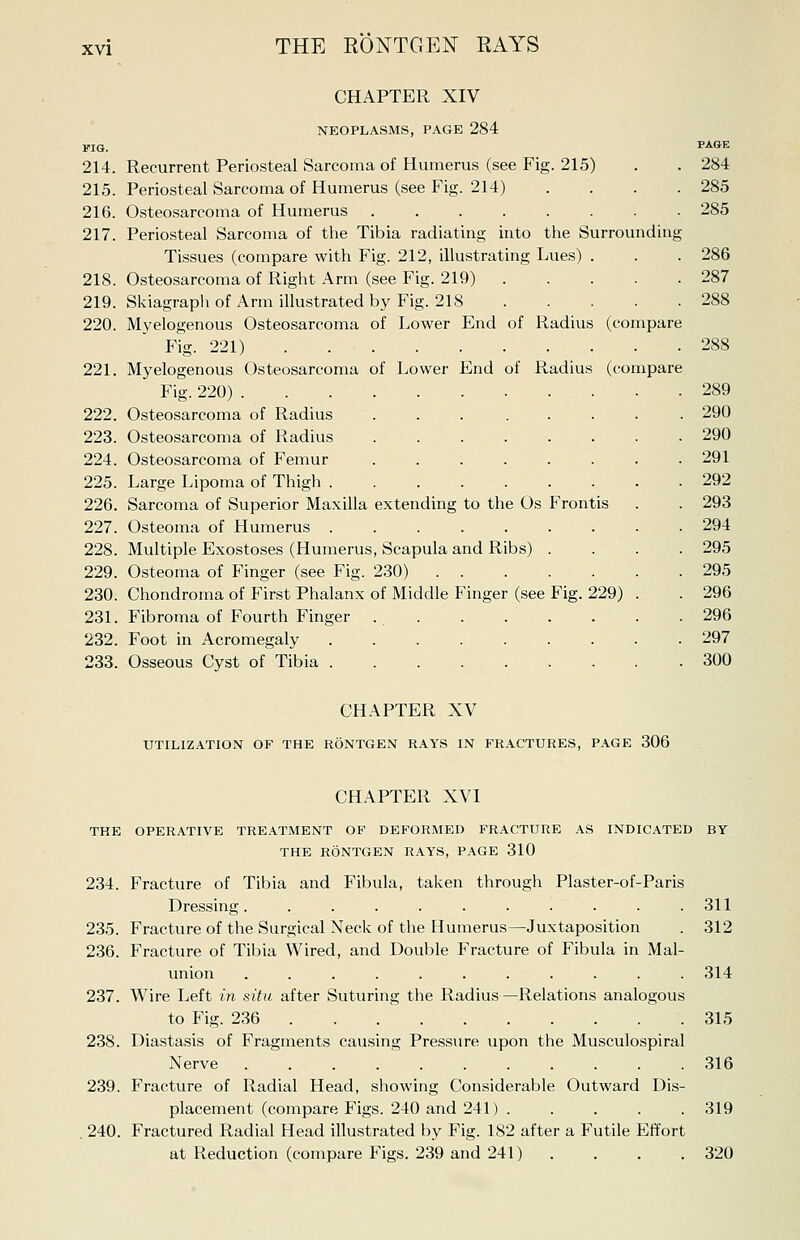 CHAPTER XIV NEOPLASMS, PAGE 284 FIG. PAGE 214. Recurrent Periosteal Sarcoma of Humerus (see Fig. 215) . . 284 215. Periosteal Sarcoma of Humerus (see Fig. 214) .... 285 216. Osteosarcoma of Humerus 285 217. Periosteal Sarcoma of the Tibia radiating into the Surrounding Tissues (compare with Fig. 212, illustrating Lues) . . . 286 218. Osteosarcoma of Right Arm (see Fig. 219) 287 219. Skiagraph of Arm illustrated by Fig. 218 288 220. Myelogenous Osteosarcoma of Lower End of Radius (compare Fig. 221) 288 221. Myelogenous Osteosarcoma of Lower End of Radius (compare Fig. 220) . 222. Osteosarcoma of Radius 223. Osteosarcoma of Radius 224. Osteosarcoma of Femur 225. Large Lipoma of Thigh . 289 290 290 291 292 226. Sarcoma of Superior Maxilla extending to the Os Frontis . . 293 227. Osteoma of Humerus ......... 294 228. Multiple Exostoses (Humerus, Scapula and Ribs) .... 295 229. Osteoma of Finger (see Fig. 230) 295 230. Chondroma of First Phalanx of Middle Finger (see Fig. 229) . . 296 231. Fibroma of Fourth Finger 296 232. Foot in Acromegaly 297 233. Osseous Cyst of Tibia 300 CHAPTER XV UTILIZATION OF THE RONTGEN RAYS IN FRACTURES, PAGE 306 CHAPTER XVI THE OPERATIVE TREATMENT OF DEFORMED FRACTURE AS INDICATED BY THE RONTGEN RAYS, PAGE 310 234. Fracture of Tibia and Fibula, taken through Plaster-of-Paris Dressing. 235. Fracture of the Surgical Neck of the Humerus—Juxtaposition 236. Fracture of Tibia Wired, and Double Fracture of Fibula in Mai union .......... 237. Wire Left in situ after Suturing the Radius—Relations analogous to Fig. 236 238. Diastasis of Fragments causing Pressure upon the Musculospiral Nerve .......... 239. Fracture of Radial Head, showing Considerable Outward Dis placement (compare Figs. 240 and 241) .... 240. Fractured Radial Head illustrated by Fig. 182 after a Futile Effort at Reduction (compare Figs. 239 and 241) 311 312 314 315 316 319 320