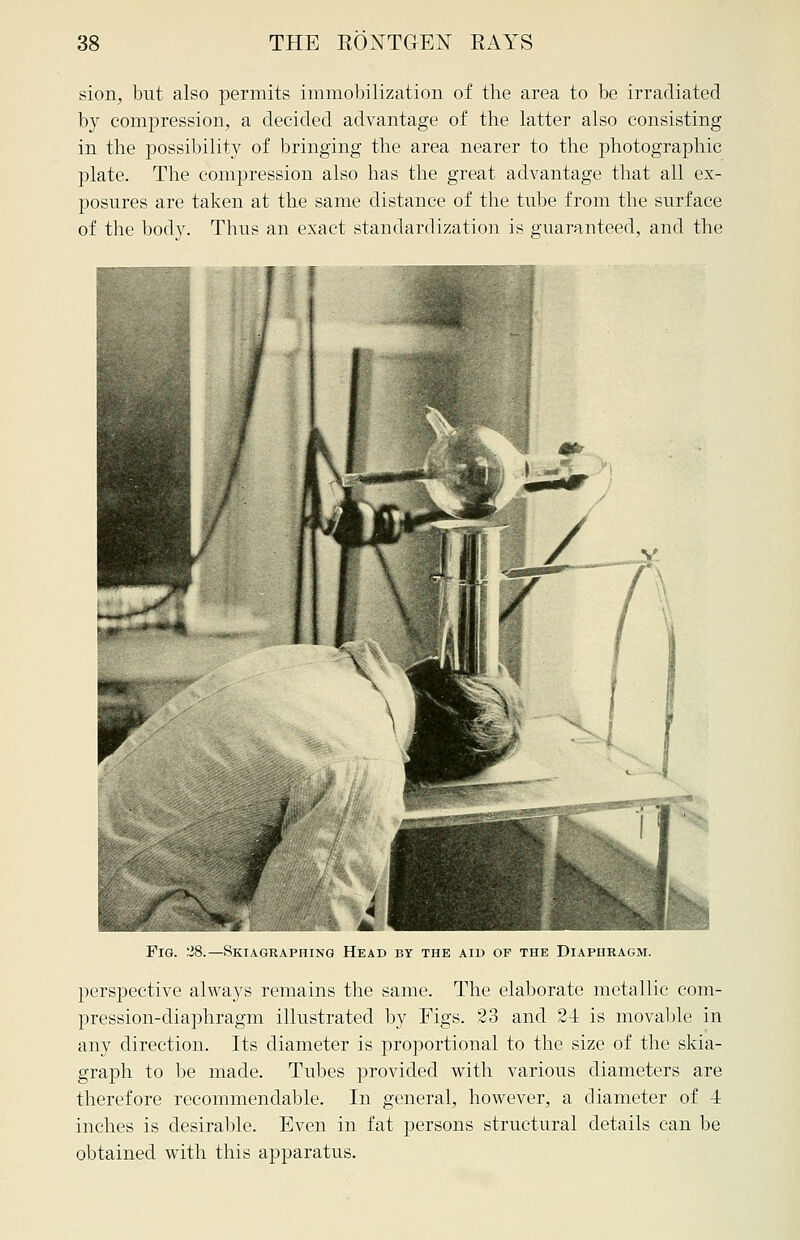 sion, but also permits immobilization of the area to be irradiated by compression, a decided advantage of the latter also consisting in the possibility of bringing the area nearer to the photographic plate. The compression also has the great advantage that all ex- posures are taken at the same distance of the tube from the surface of the body. Thus an exact standardization is guaranteed, and the Skiagraphing Head by the aid of the Diaphragm. perspective always remains the same. The elaborate metallic com- pression-diaphragm illustrated by Figs. 23 and 2-i is movable in any direction. Its diameter is proportional to the size of the skia- graph to be made. Tubes provided with various diameters are therefore recommendable. In general, however, a diameter of 4 inches is desirable. Even in fat persons structural details can be obtained with this apparatus.